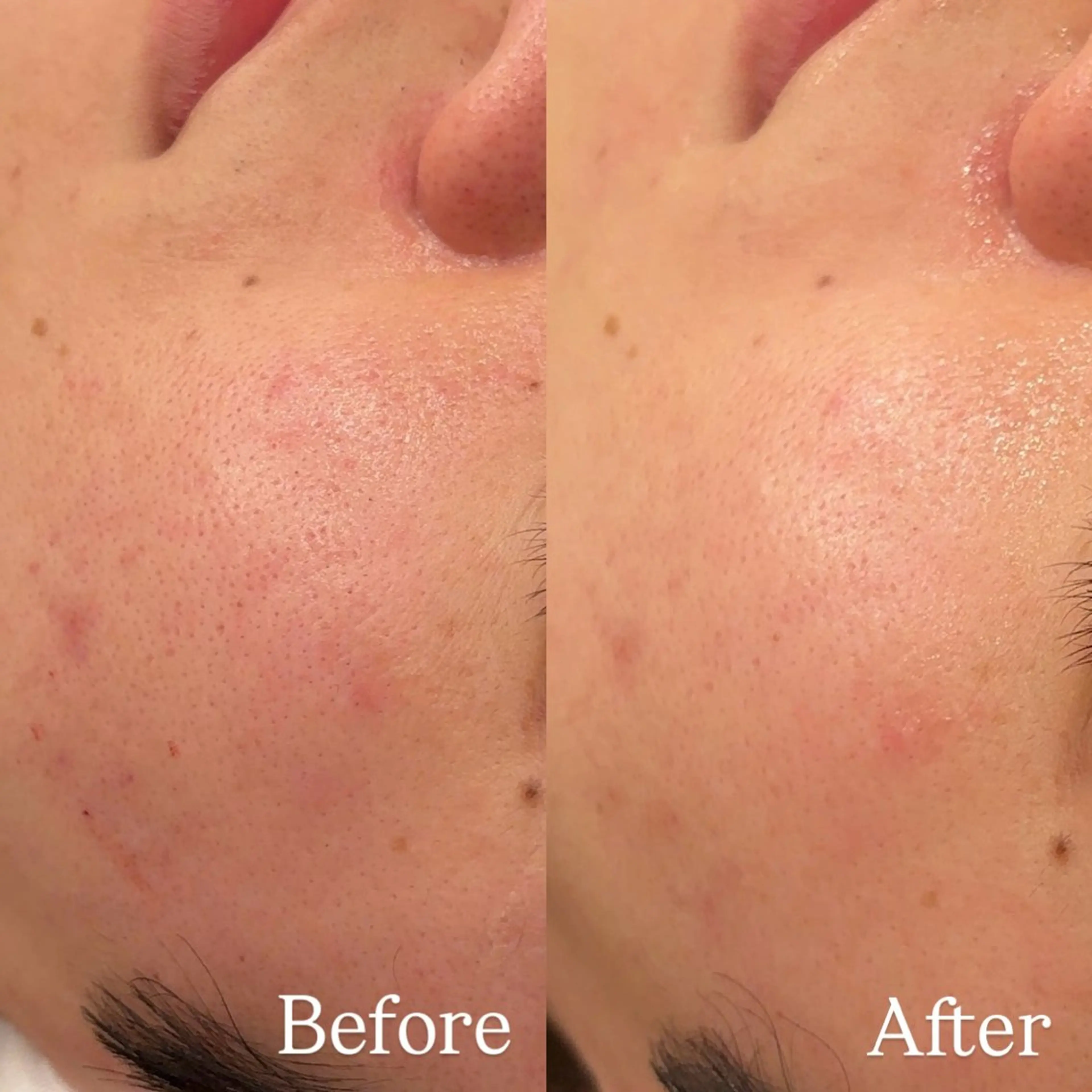 Hari Lounge恵比寿所属・chika🦋 ハリラウンジ恵比寿のエステ・リラクイメージ