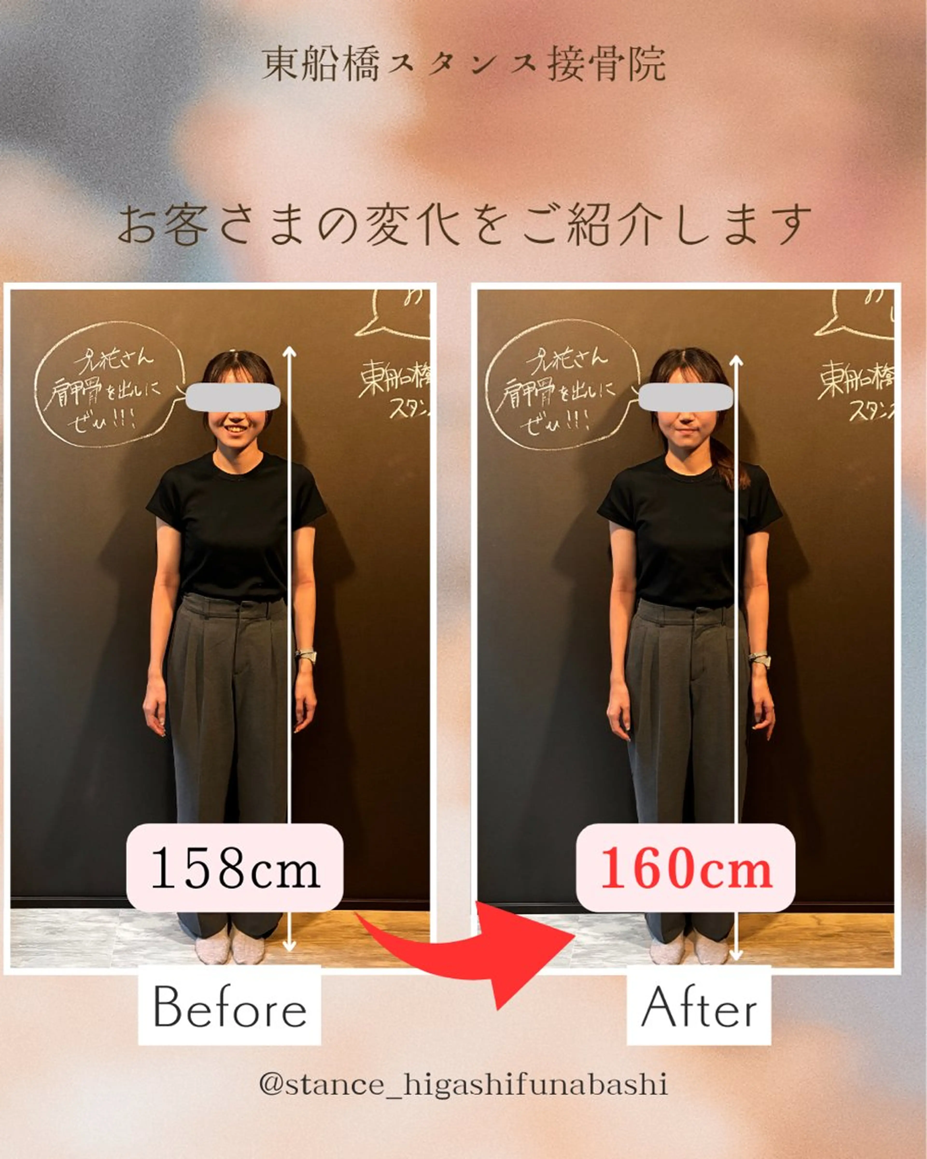 【初回限定】姿勢と小顔のコース|ブライダル特化の接骨院だからこそ出来る究極のご褒美整体。-5歳肌、目線が変わる体験コースの写真