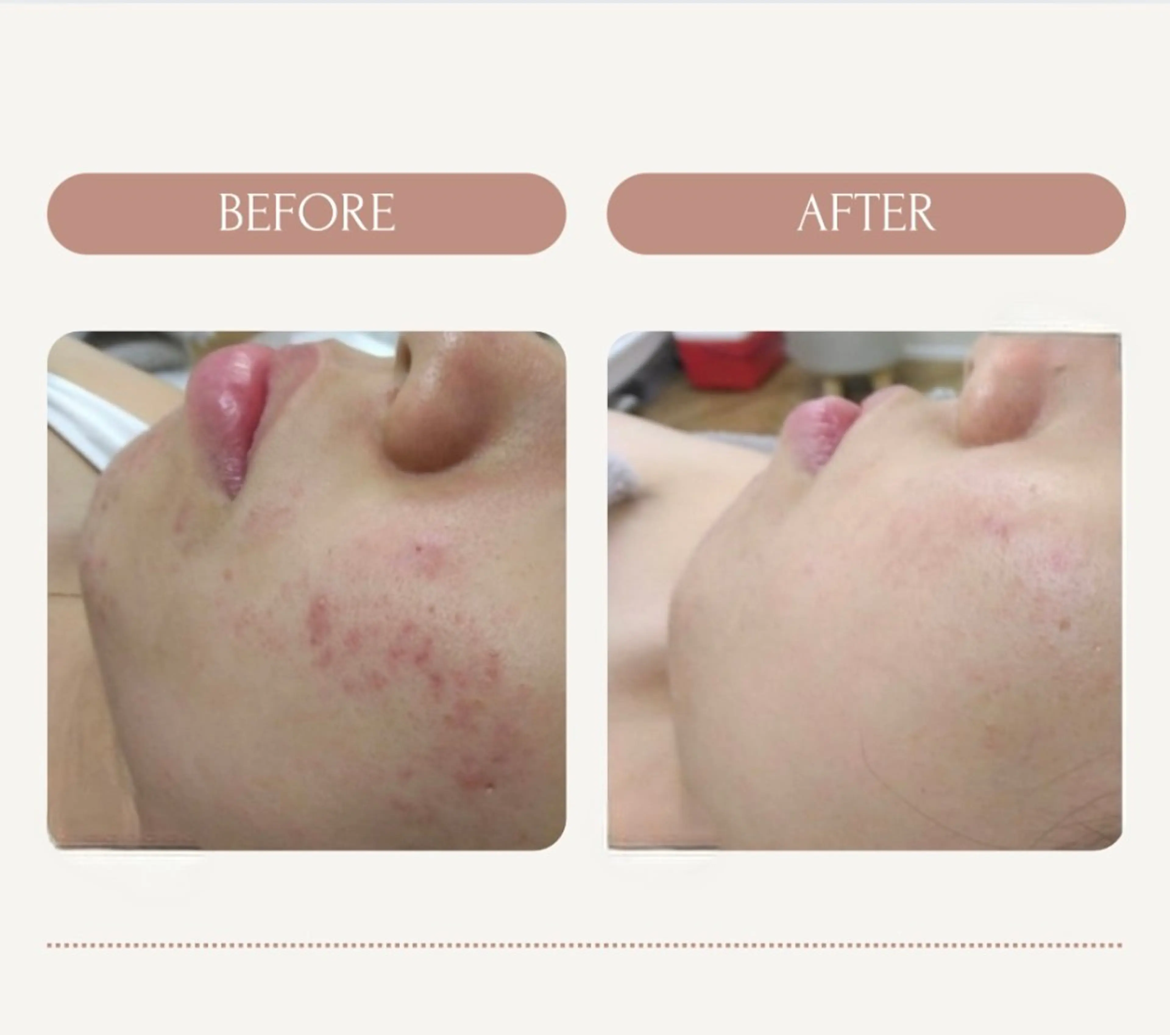 エステ ピーリング＆脱毛 maoのエステ・リラクイメージ