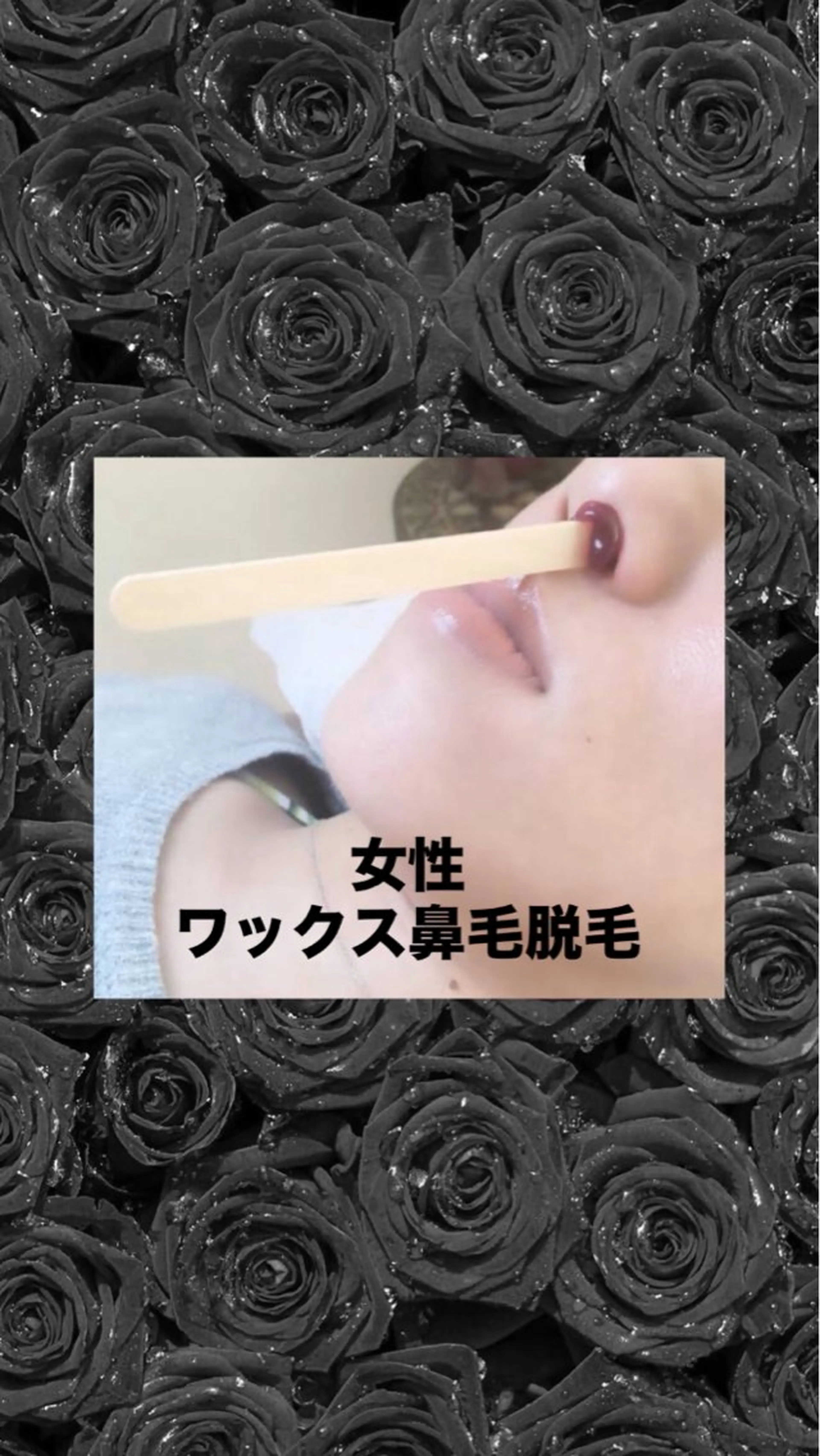 脱毛 メディカルエステ マドンナのエステ・リラクイメージ