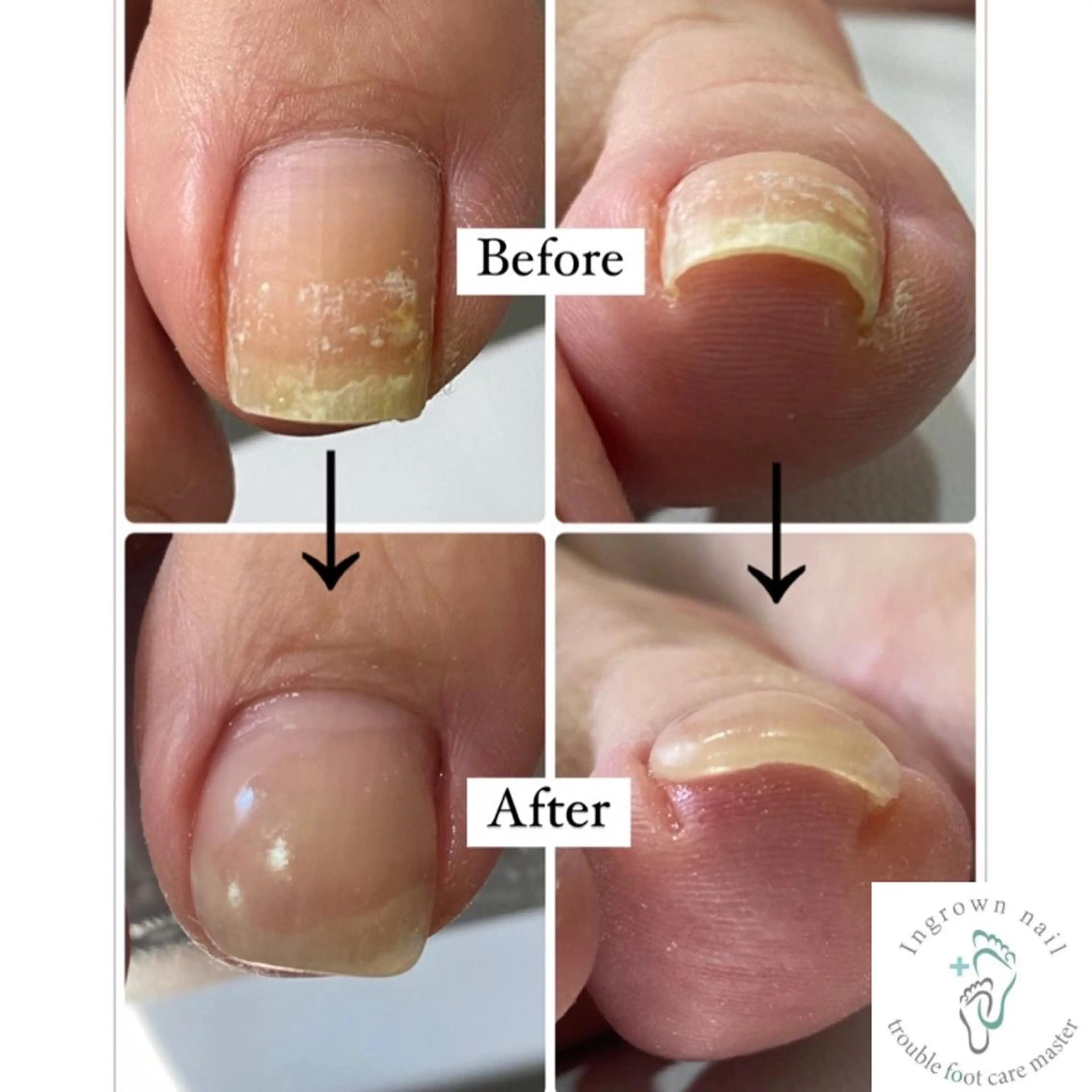 ネイル 梨ネイルとJR茨木所属・井上 愛梨のネイルデザイン