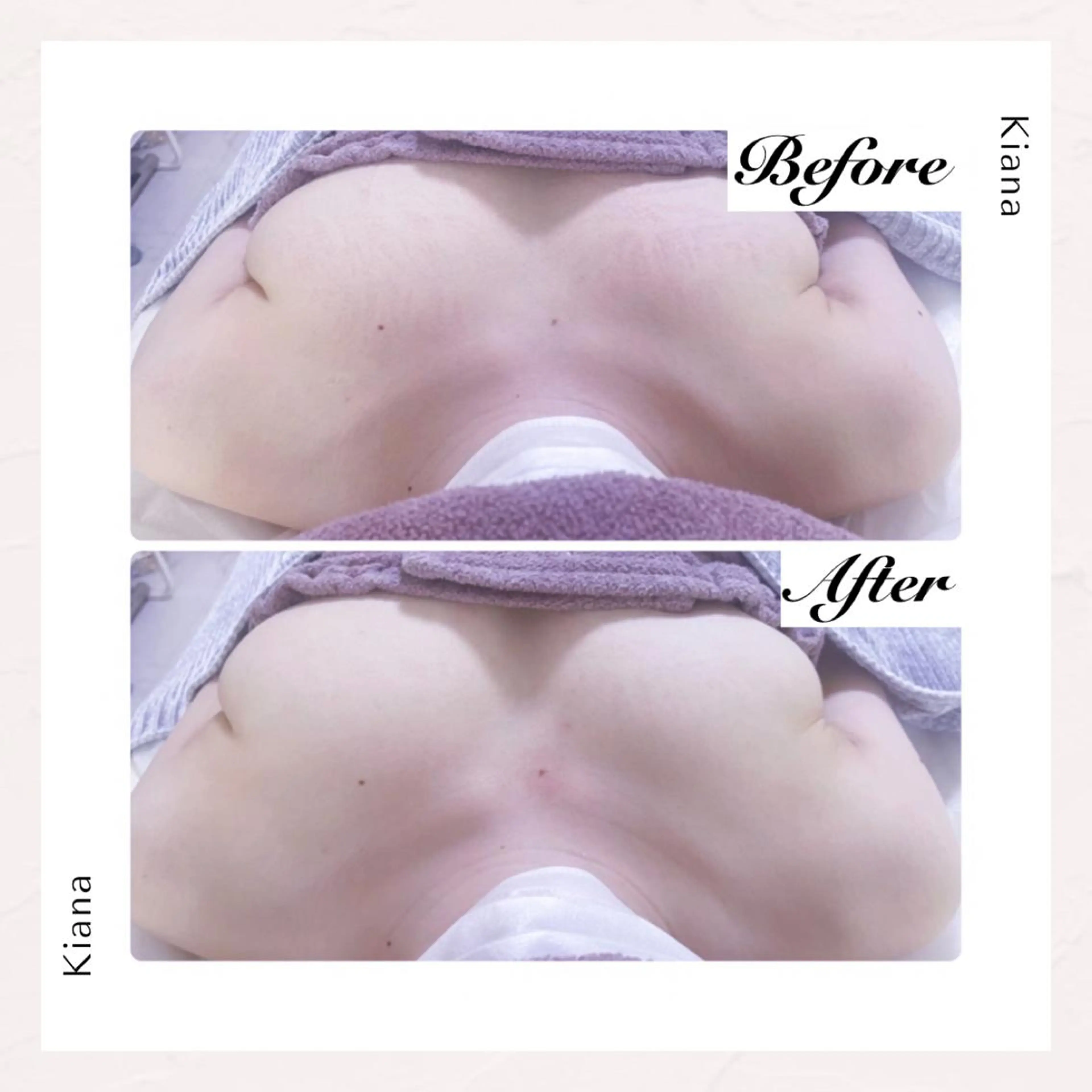 エステ リラク バスト専門Kiana 風のエステ・リラクイメージ