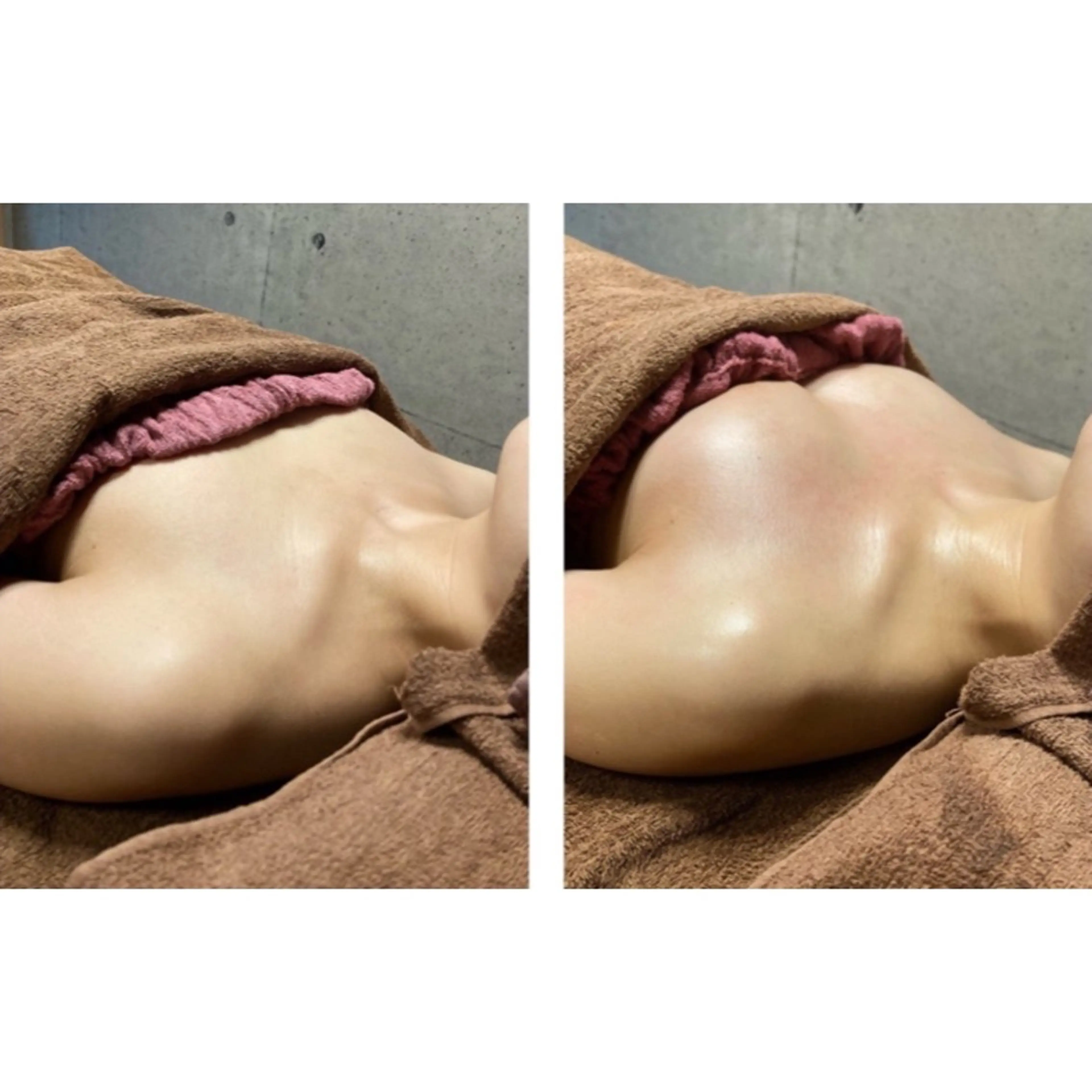 ダイエットしたいけどバストアップもしたい！欲張りなあなたの願望叶えます！の写真