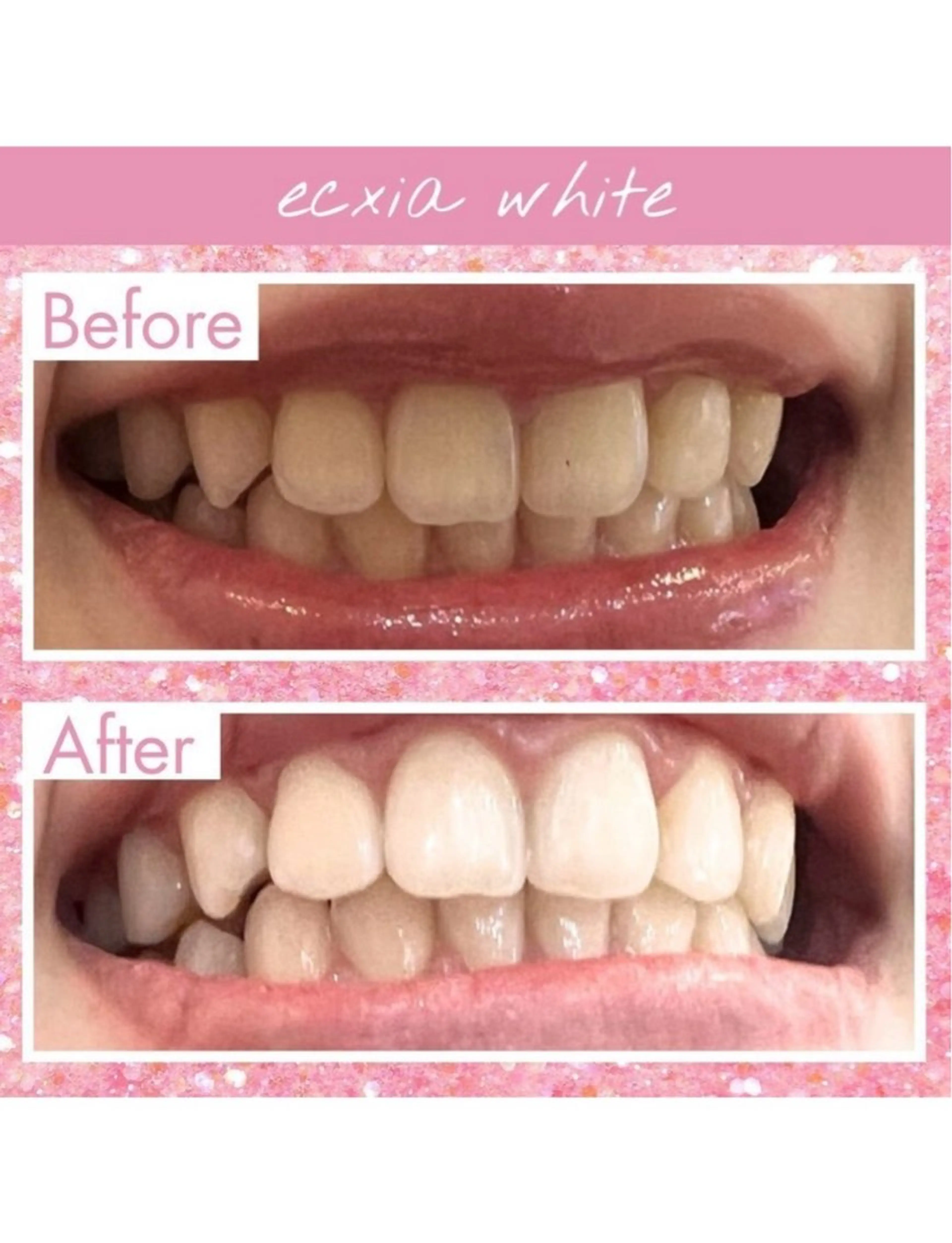 セルフホワイトニングサロン　エクシアホワイト西尾店所属・エクシアホワイト西尾 堀内恵のその他イメージ