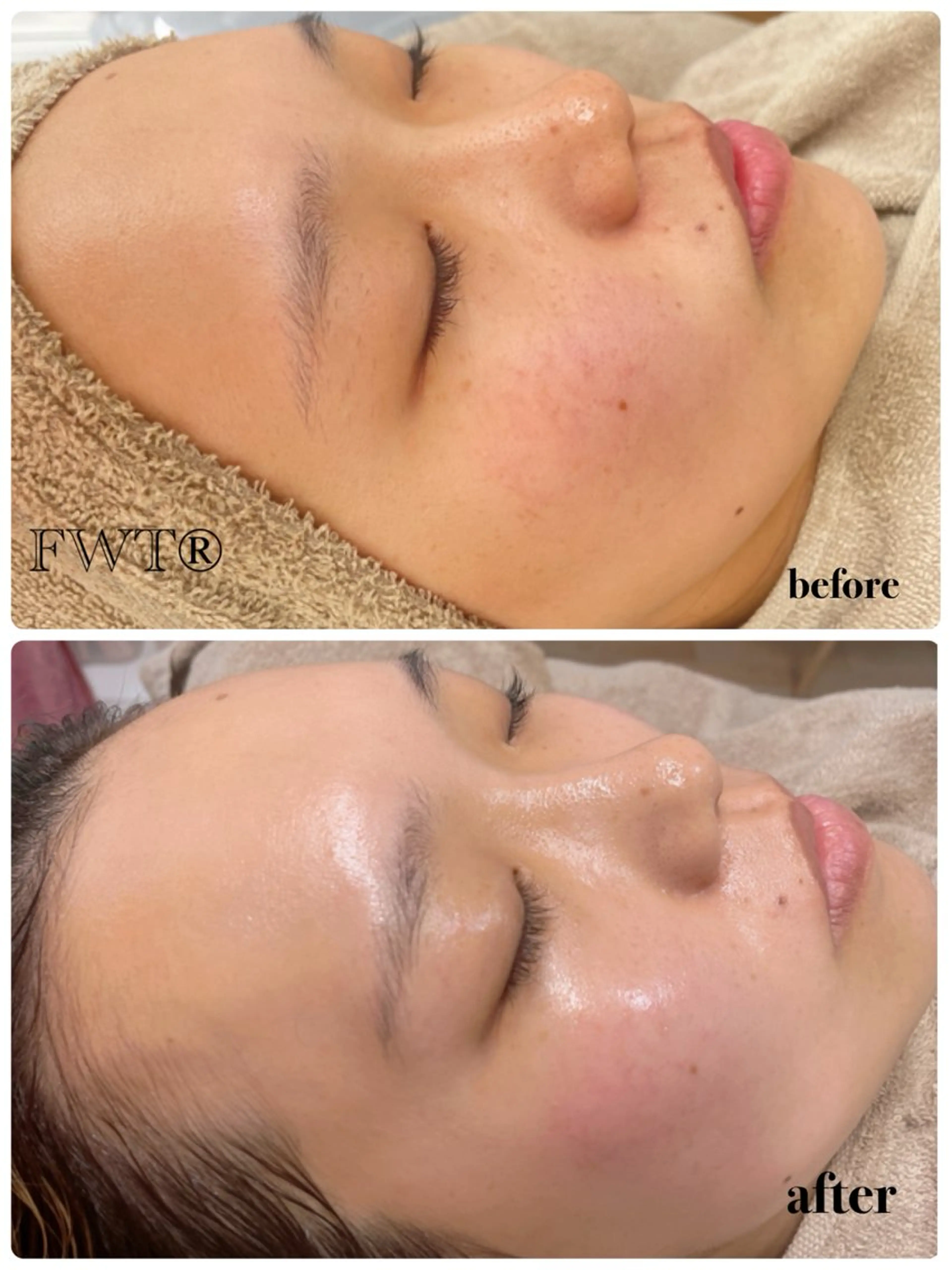 脱毛 ビューティーサロン Lino🫧mayuのエステ・リラクイメージ