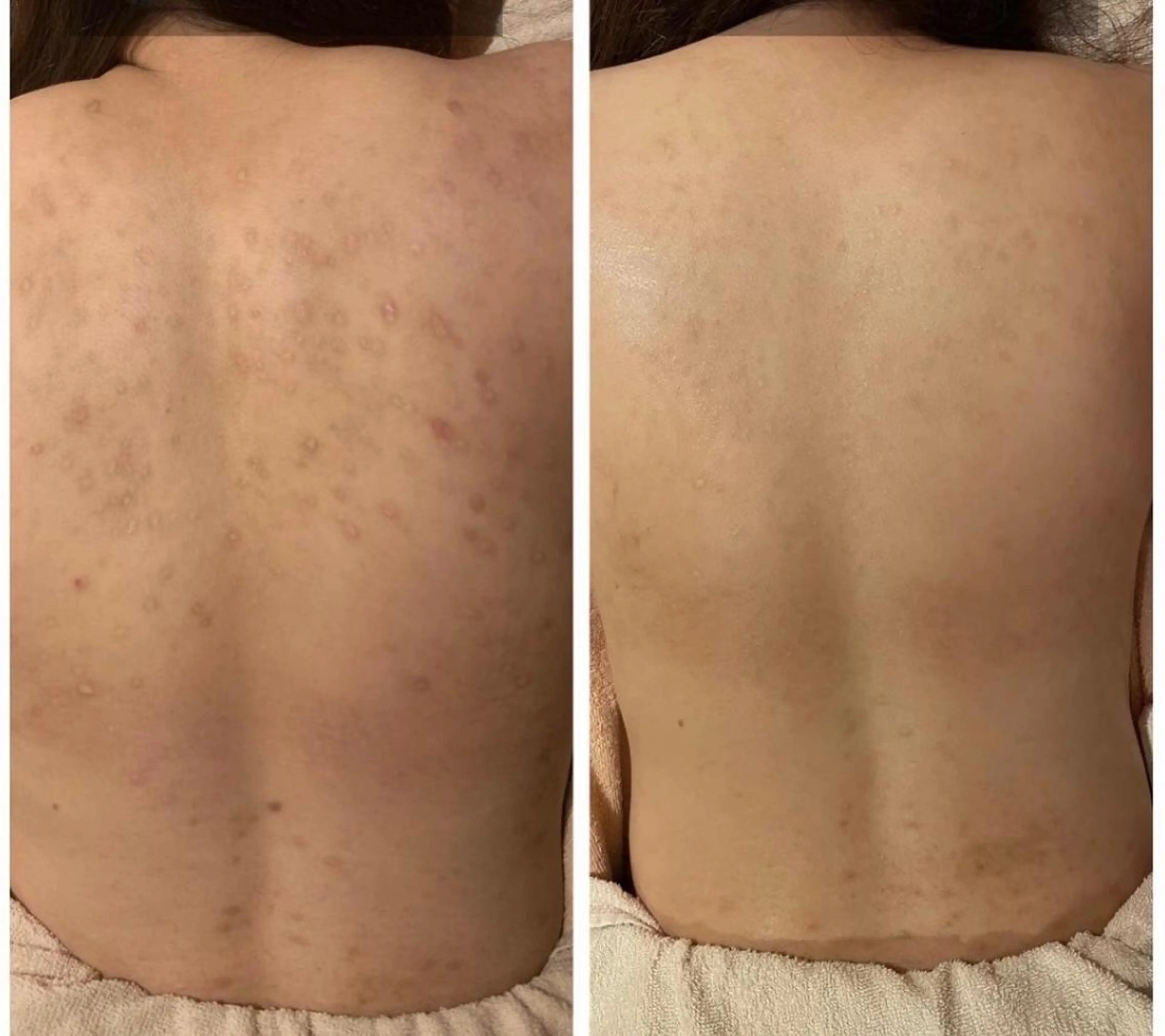 その他 for woman所属・森 美優のエステ・リラクイメージ