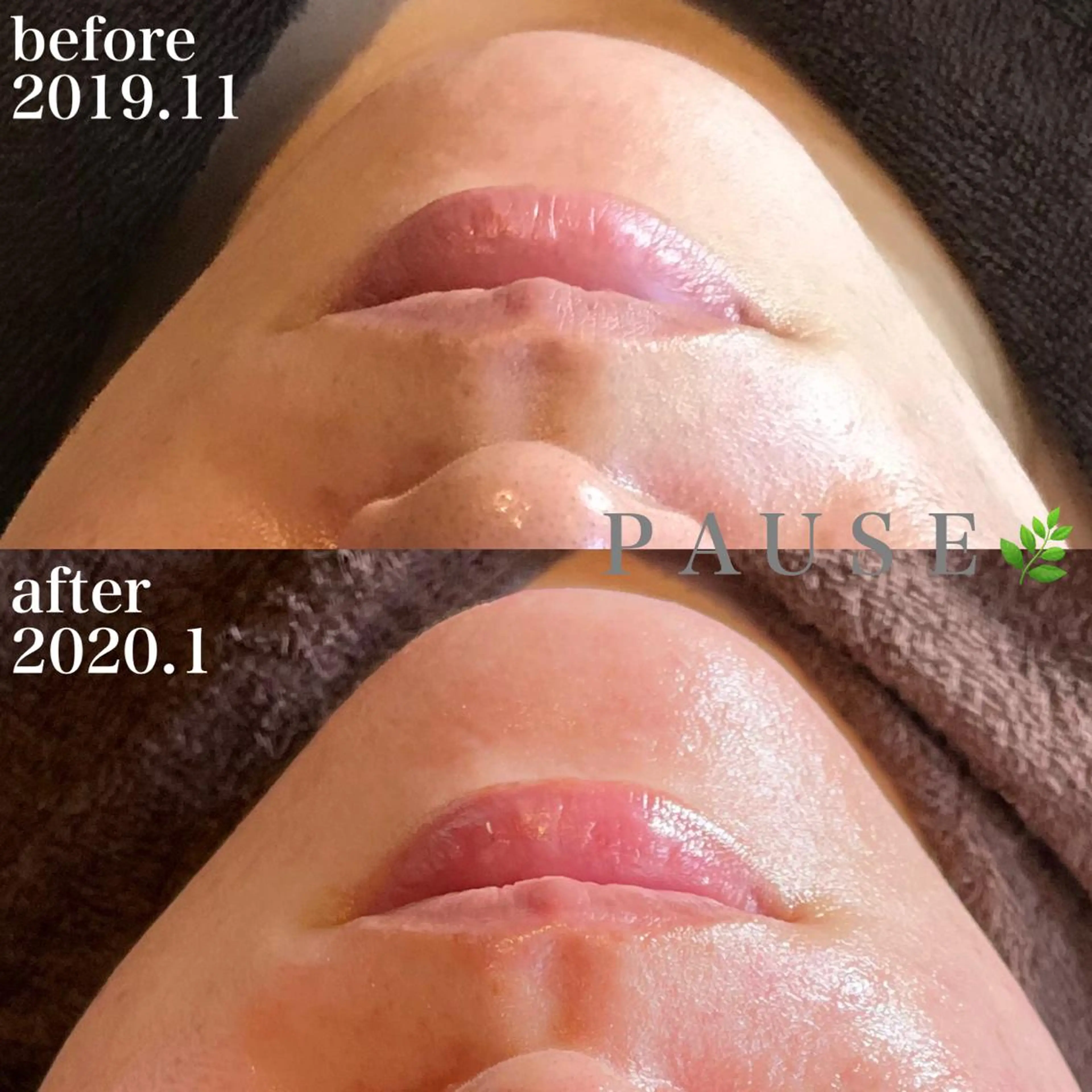 エステ 浜野 恵美のエステ・リラクイメージ