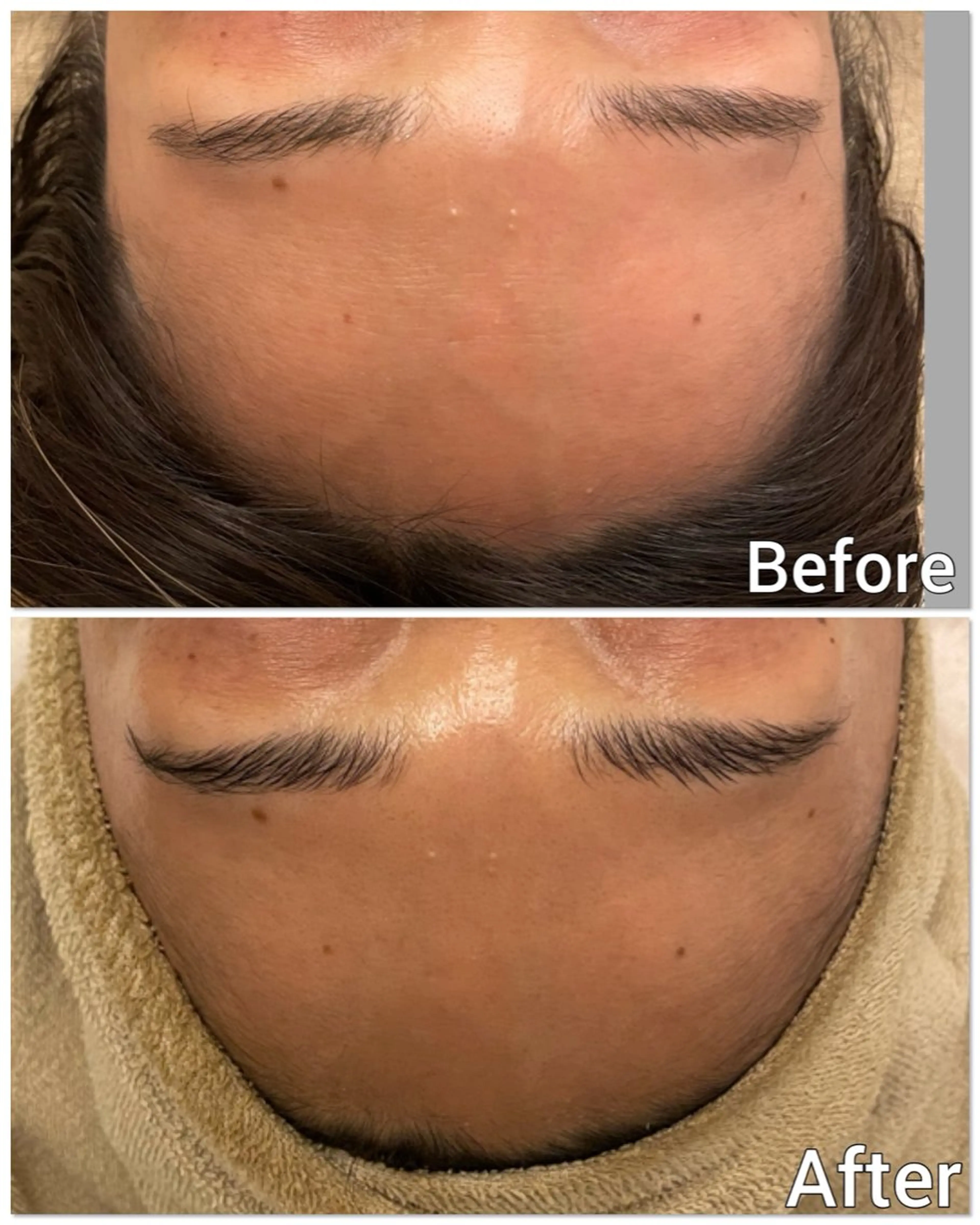 エステ ハーブピーリング 肌再生ピーリング/のエステ・リラクイメージ