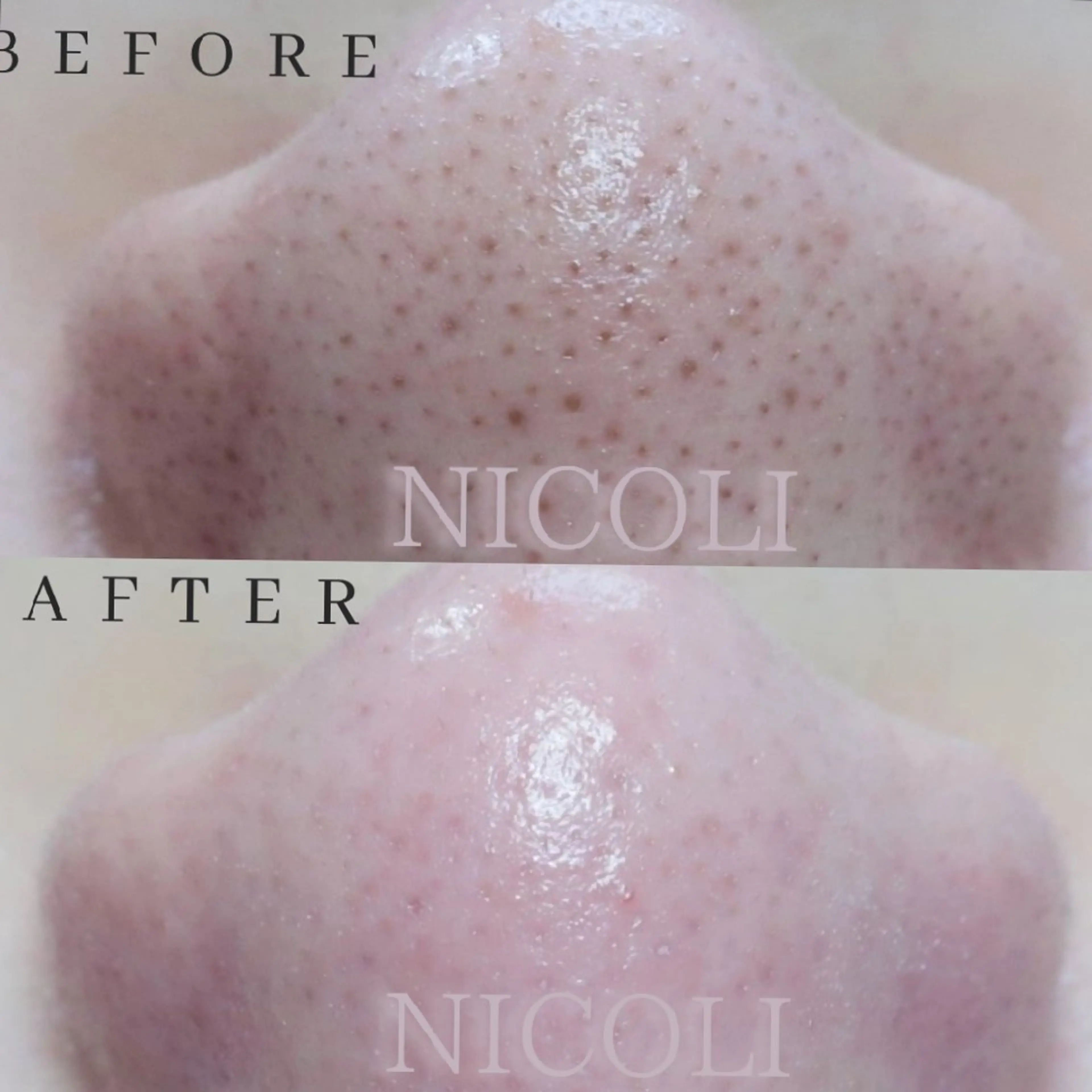 エステ エステサロン NICOLIのエステ・リラクイメージ