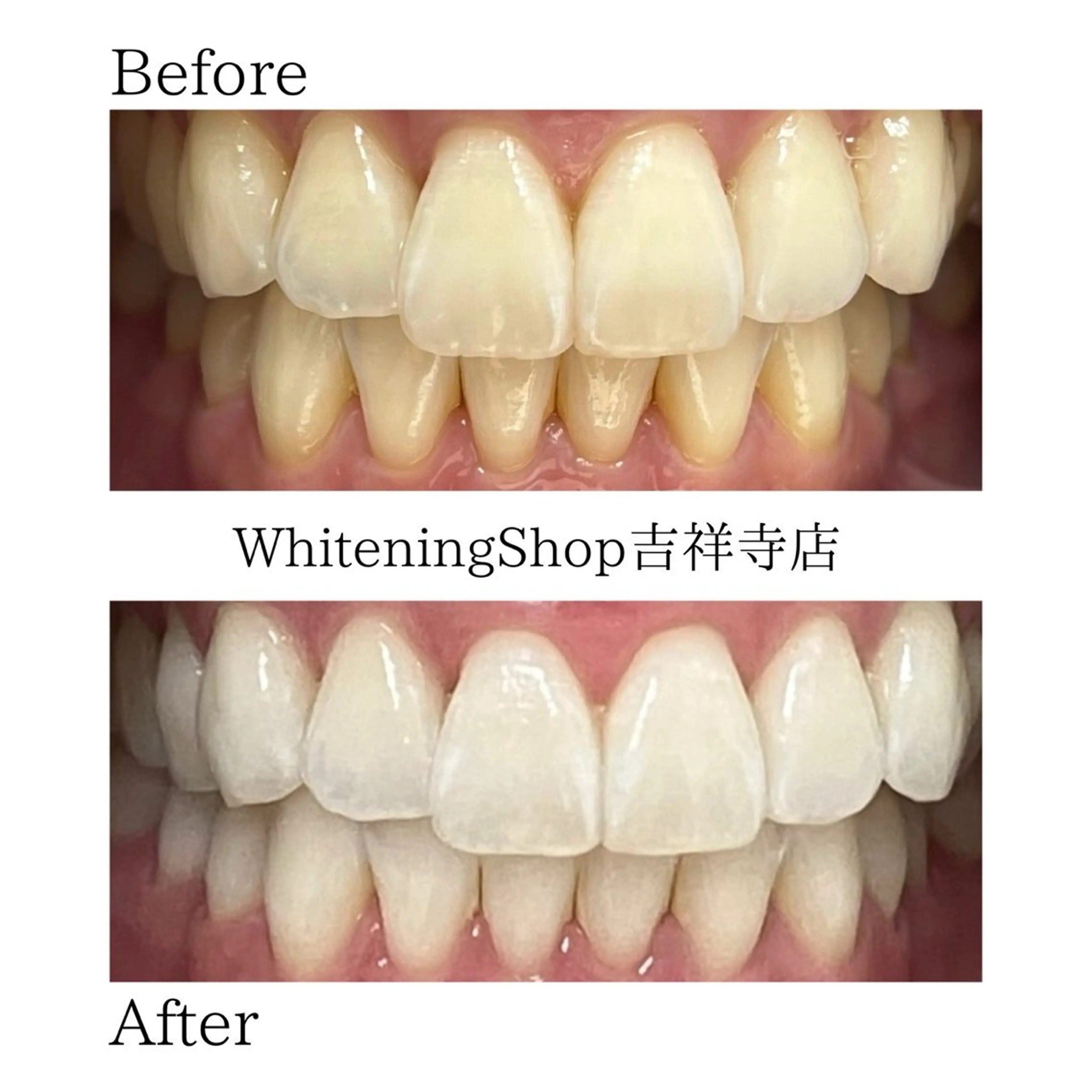 エステ リラク ホワイトニング ショップ吉祥寺店のエステ・リラクイメージ