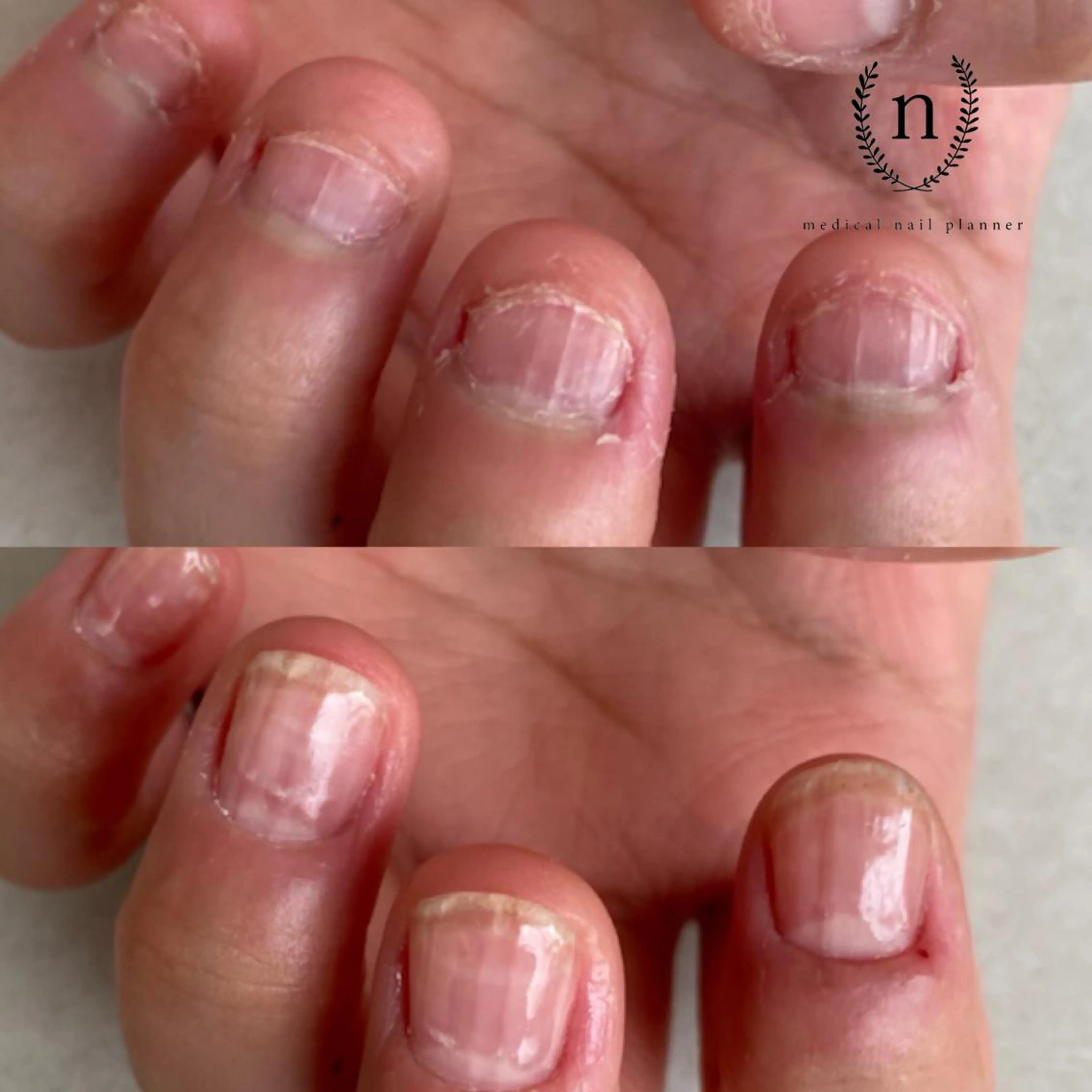 ネイル Rio 𓍼のネイルデザイン