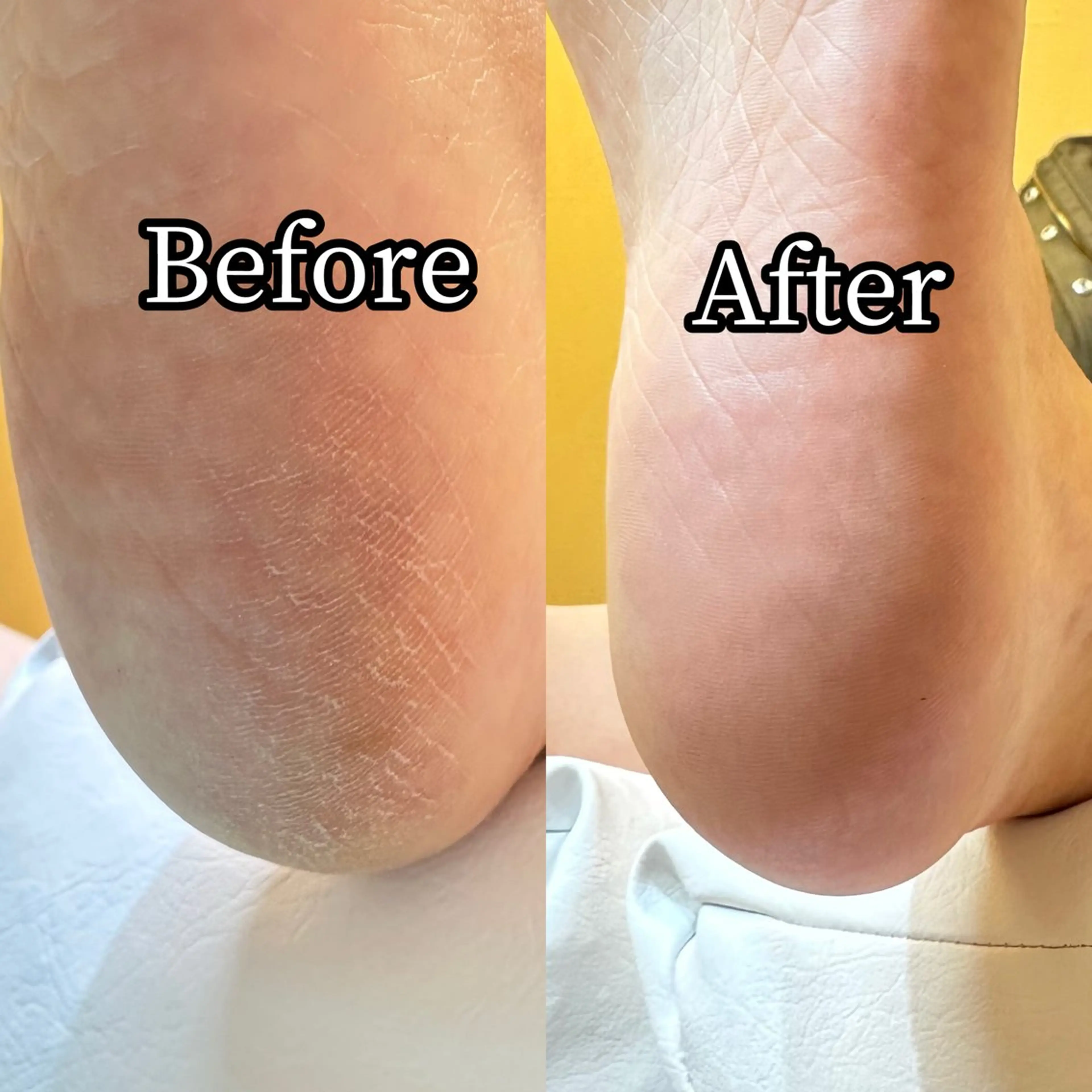 ネイル 巻き爪補正店 横浜関内店のネイルデザイン