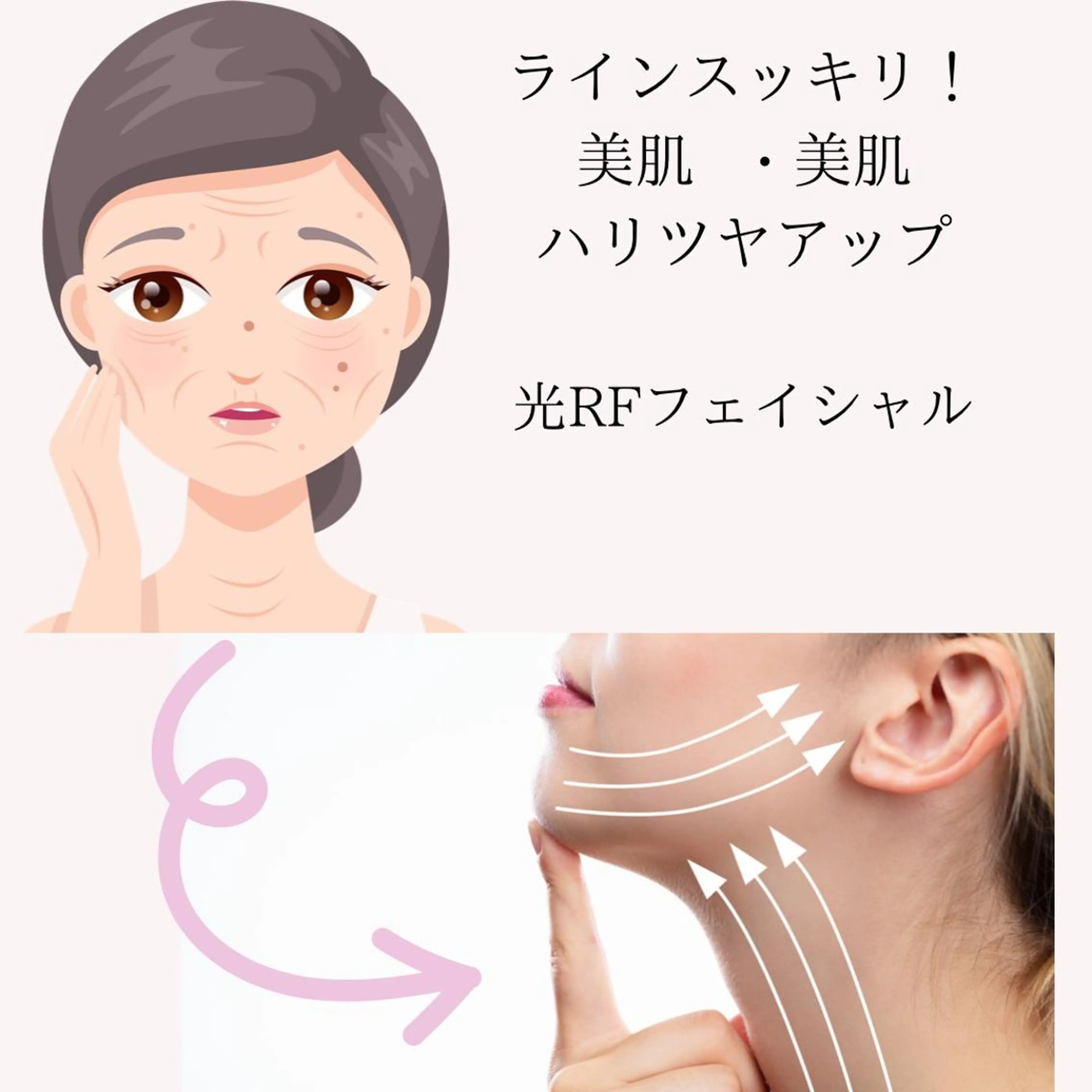 ラインスッキリ❣️美白美肌❣️光フェイシャル60分の写真