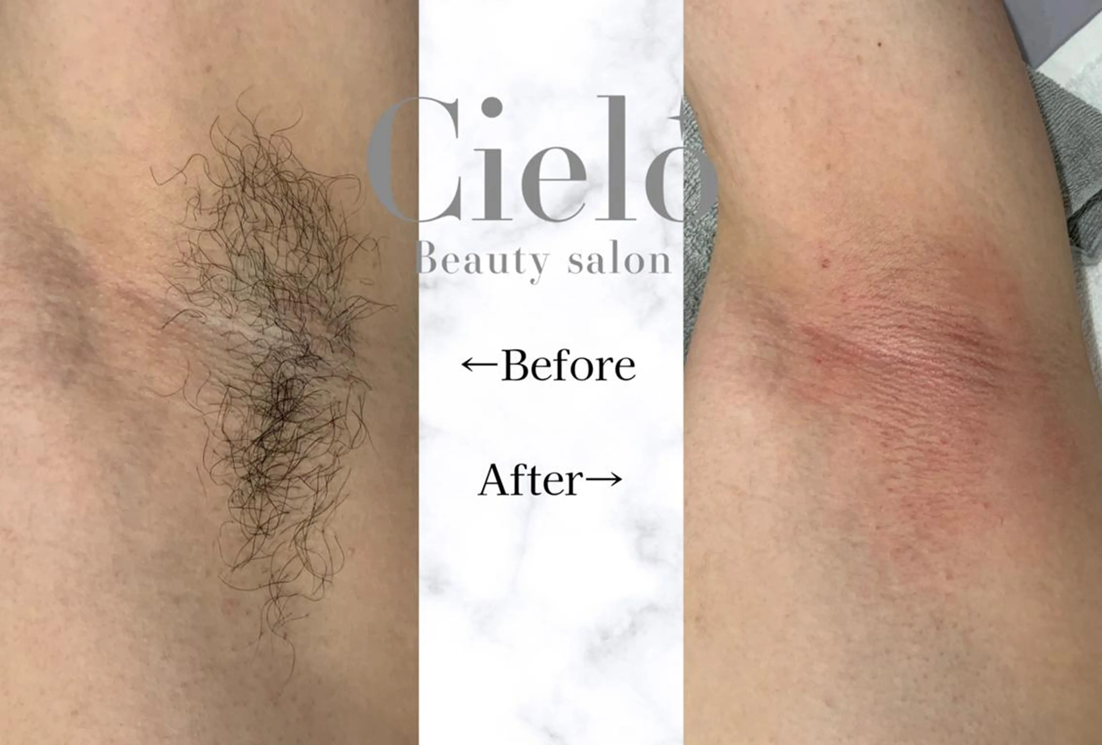 kawasaki sugarのエステ・リラクイメージ