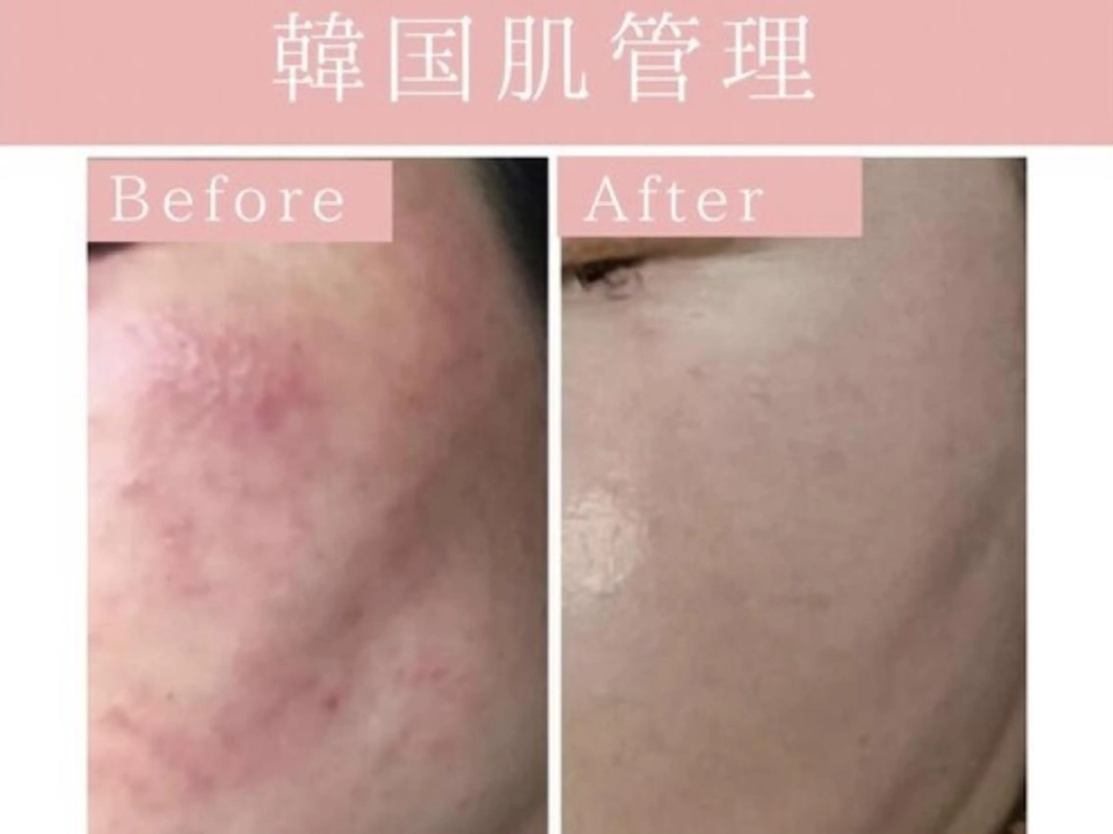 エステ Luana武蔵小杉店 (ルアナ)のエステ・リラクイメージ