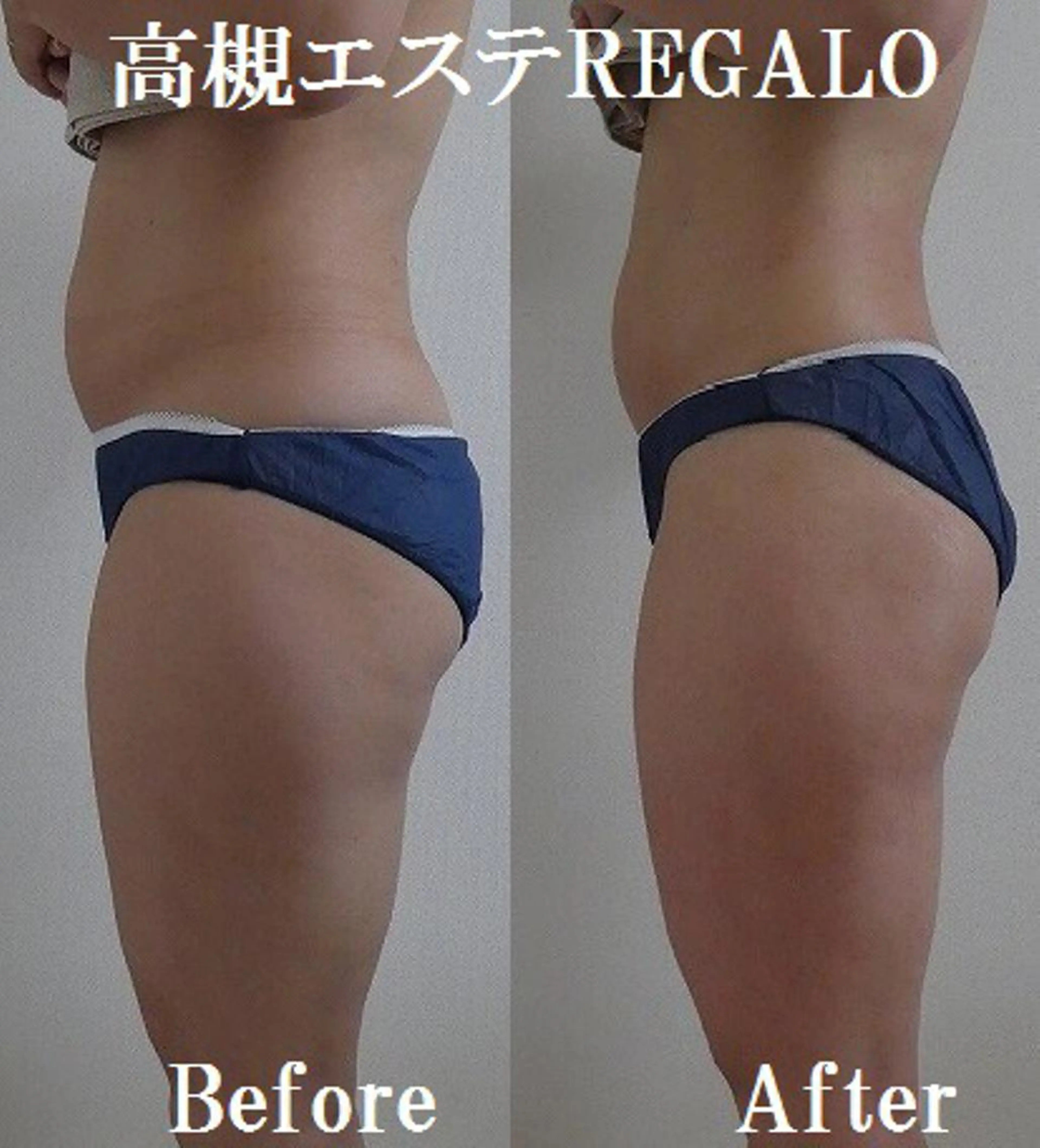 エステ リラク REGALO所属・矢野 さやかのエステ・リラクイメージ