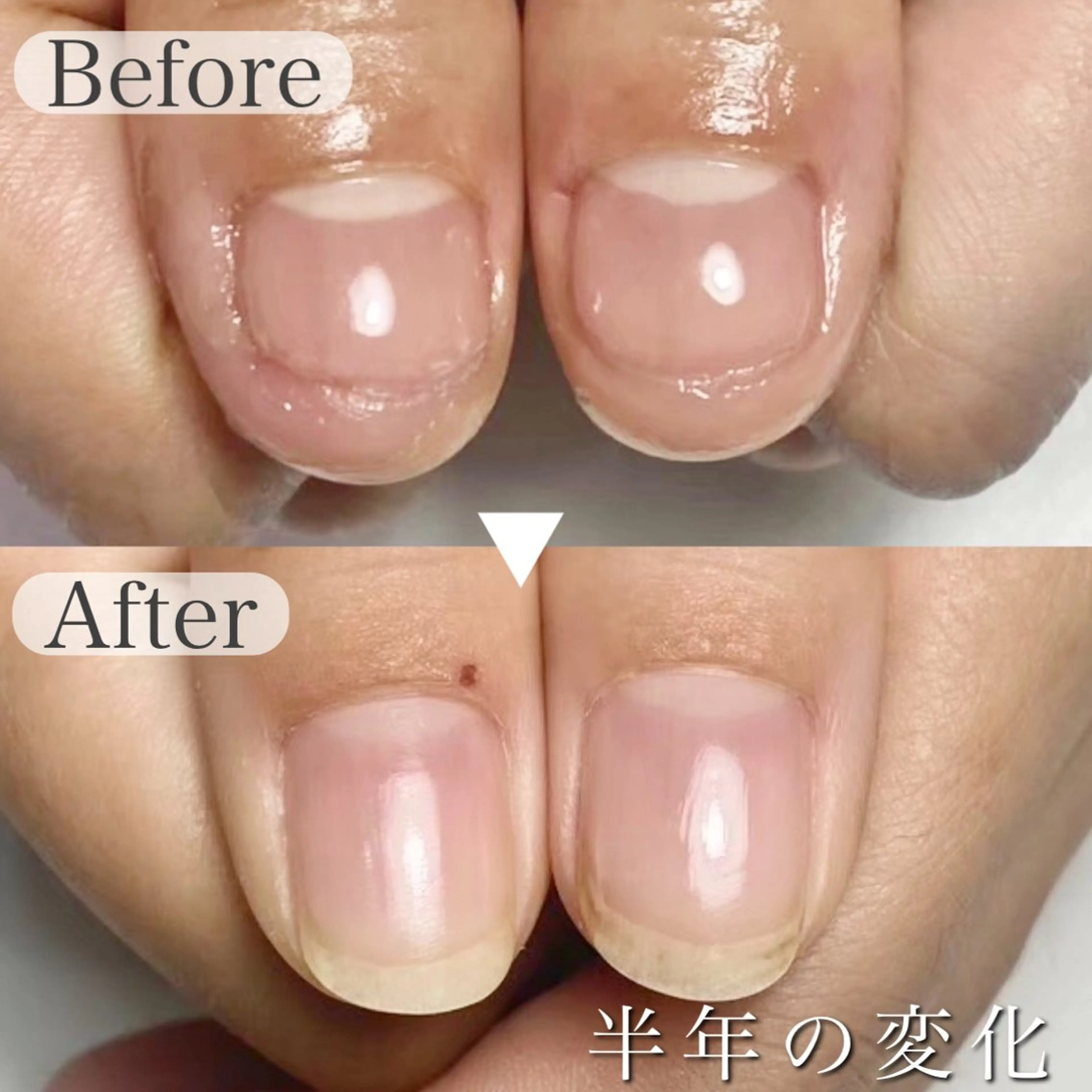 ◎ピンクを伸ばす深爪卒業！コースの写真