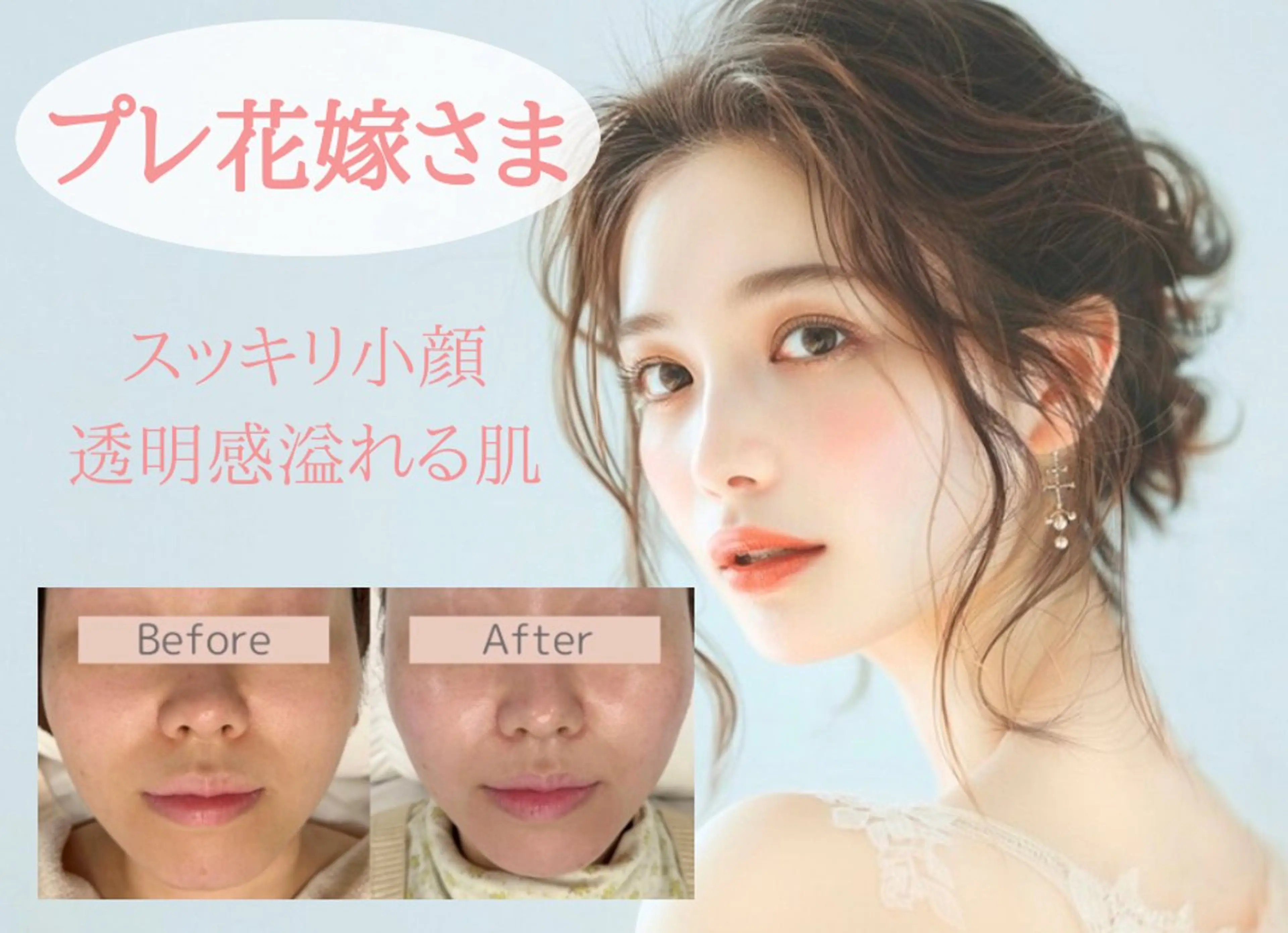 エステ べアール所属・小顔/毛穴/ニキビ salon bealのその他イメージ