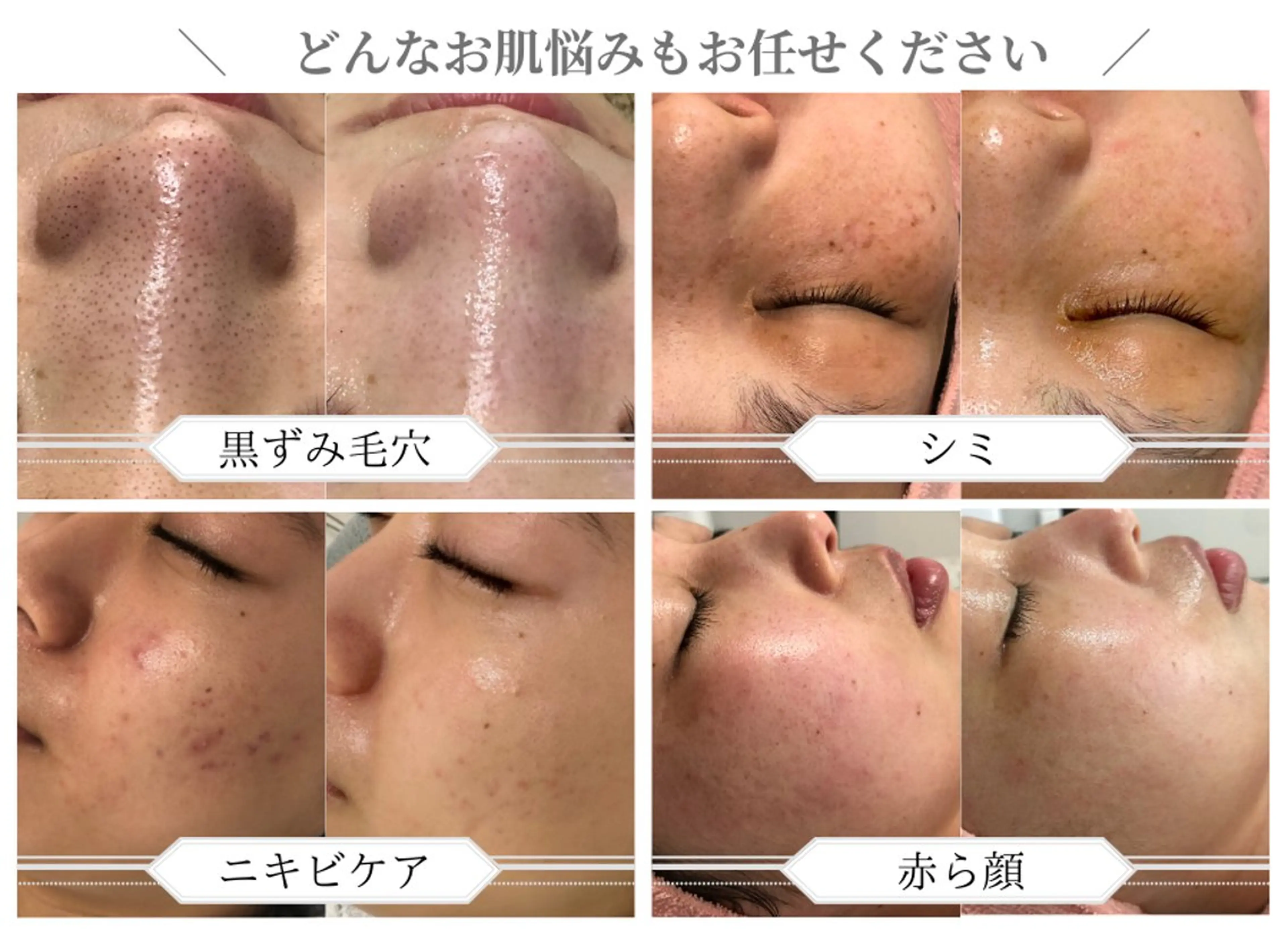 肌質改善サロン BestBelleのエステ・リラクイメージ