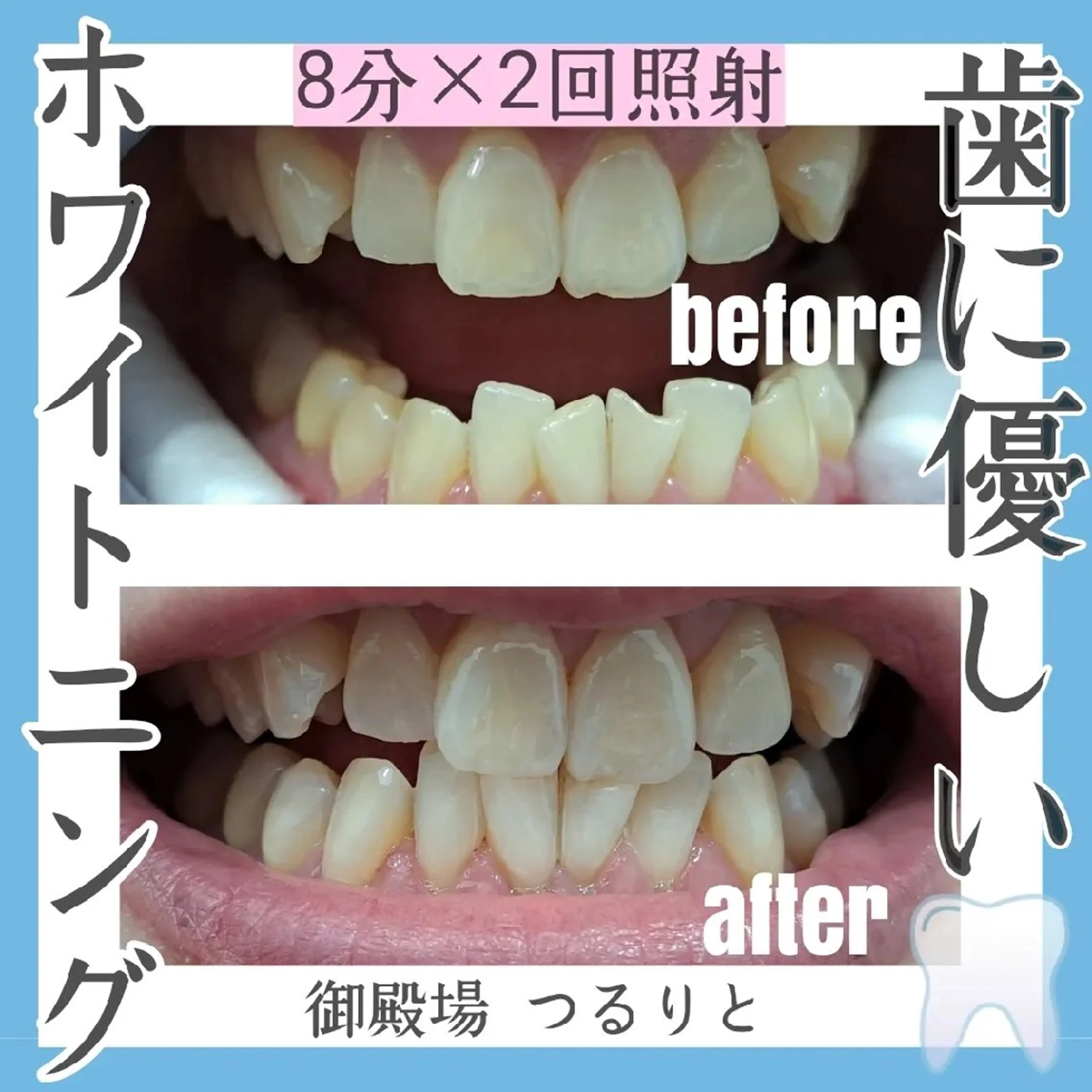 美肌脱毛サロン つるりと御殿場店所属・美肌脱毛サロン つるりとのその他イメージ