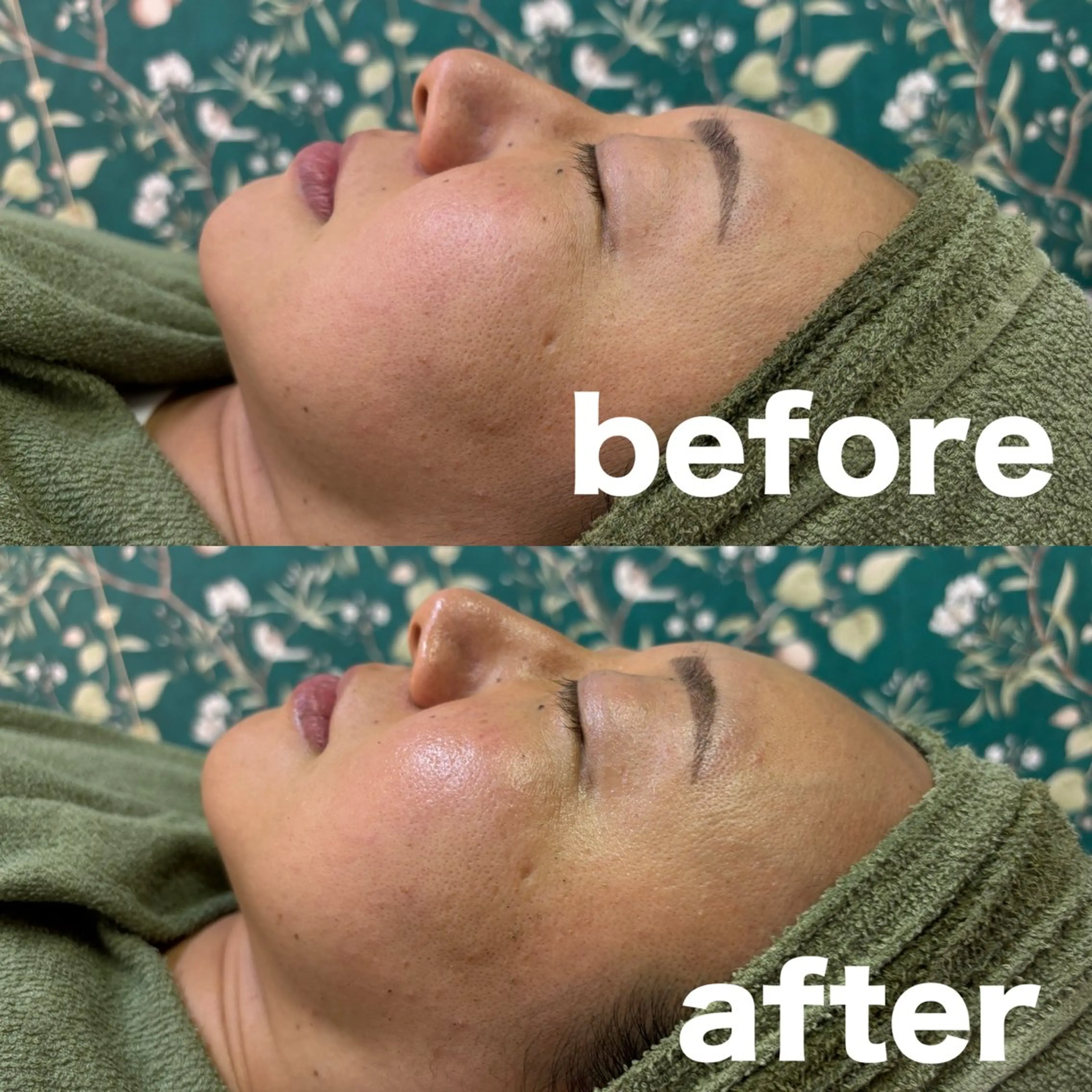 陶肌トリートメント(ハーブ2g➕生酵素1g)の写真