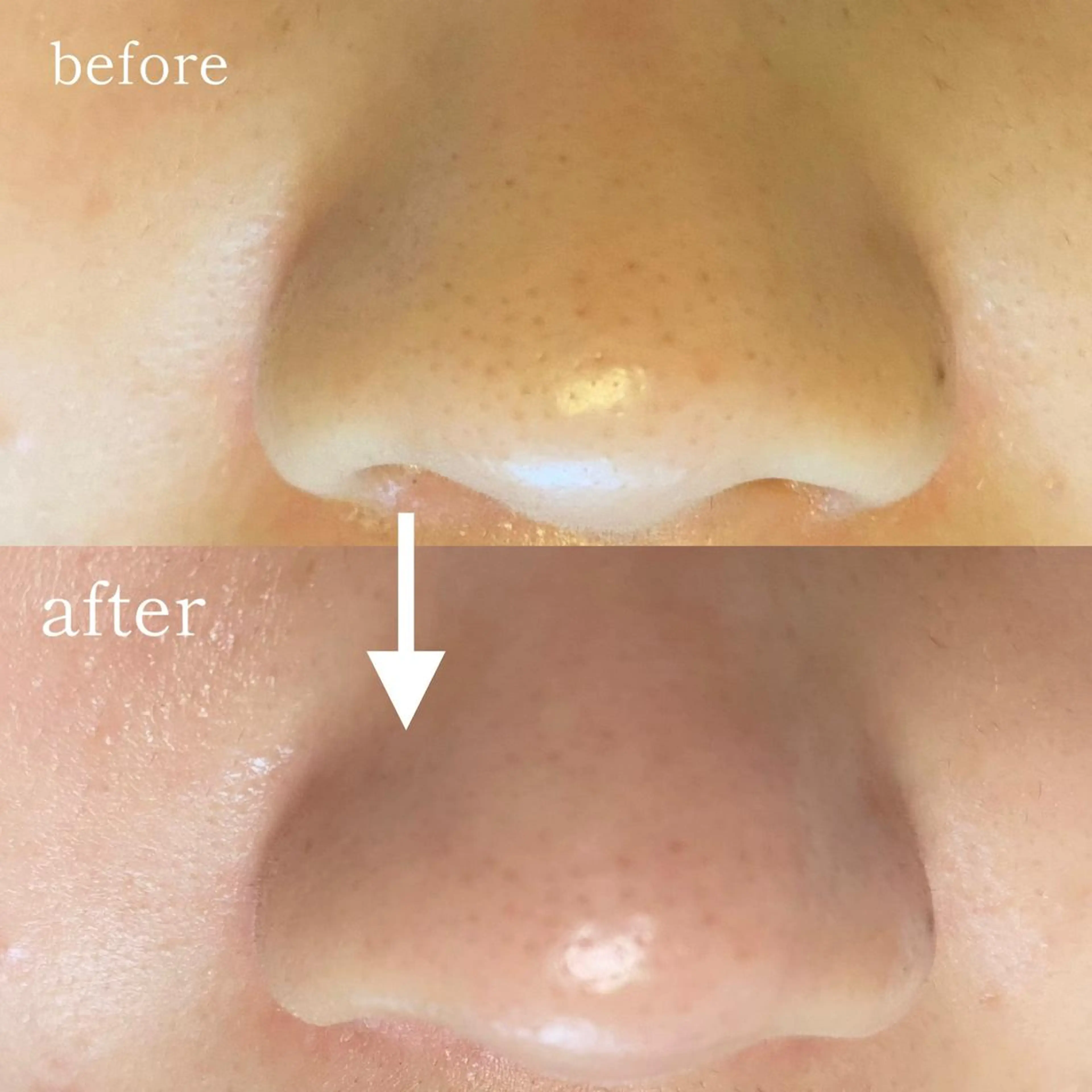 毛穴専門サロン　フルール所属・フルールFululu 自由が丘のエステ・リラクイメージ