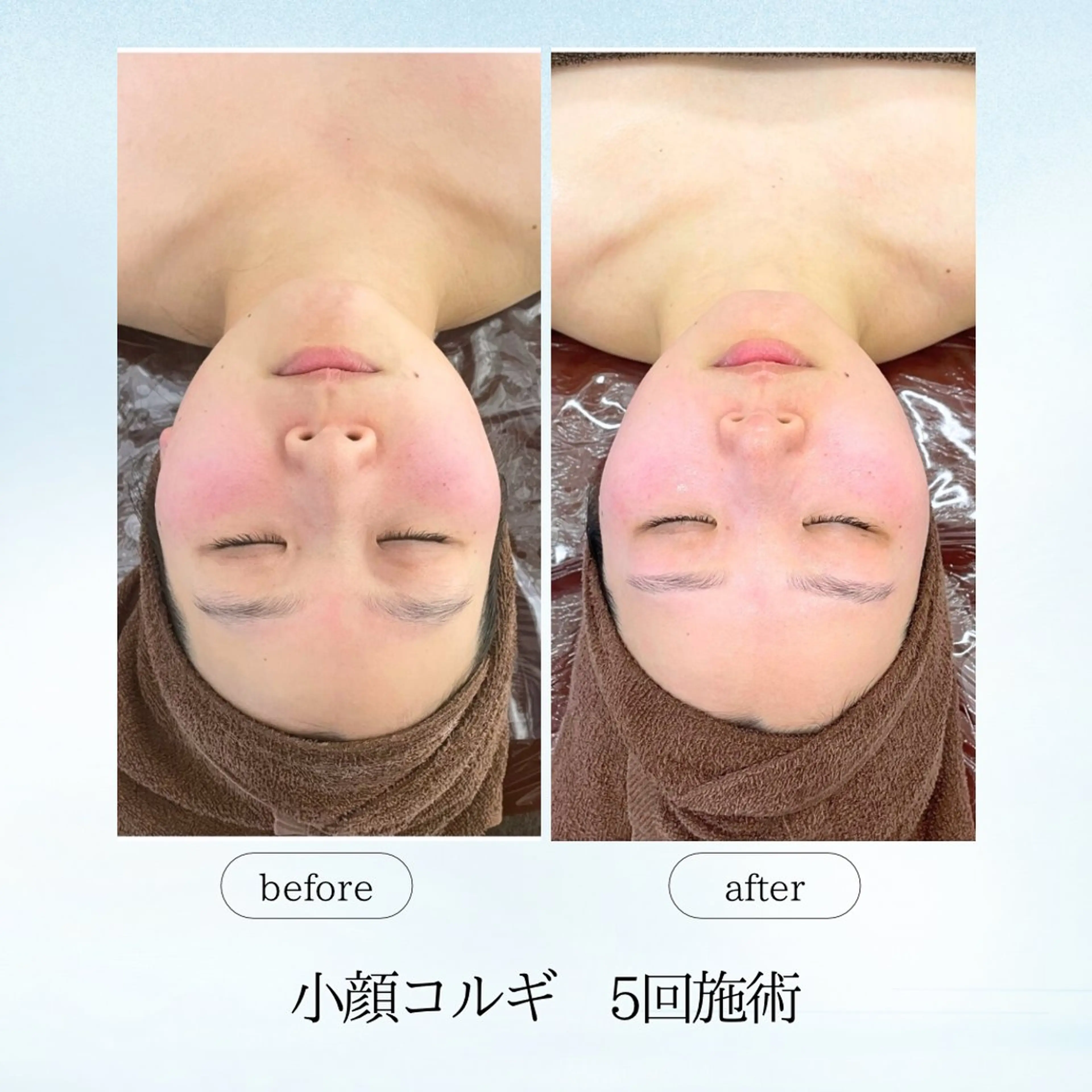 エステ リラク espresso,所属・《痩身、小顔専門店》 エスプレッソのエステ・リラクイメージ