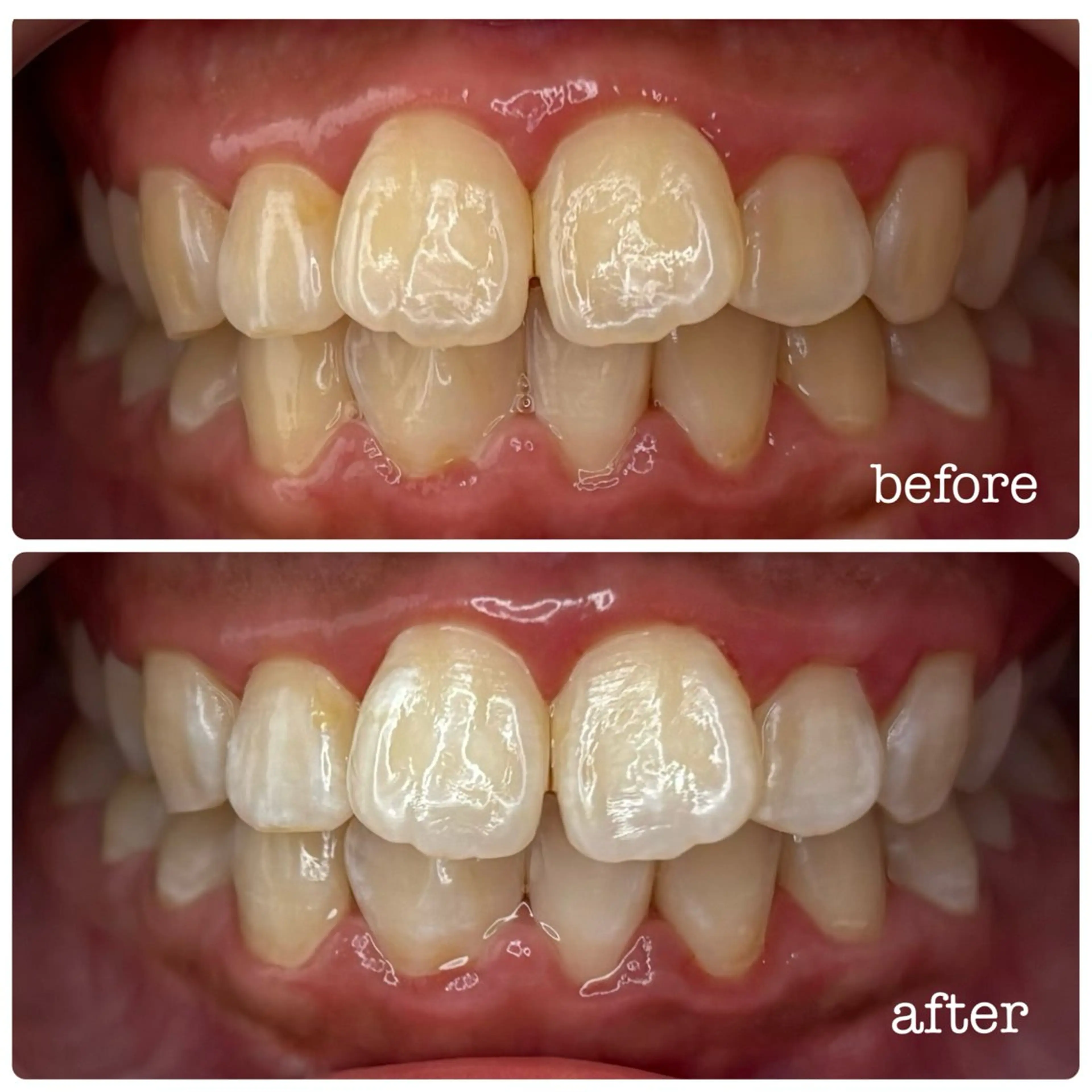 DH. MISATOの眉毛・アイブロウイメージ