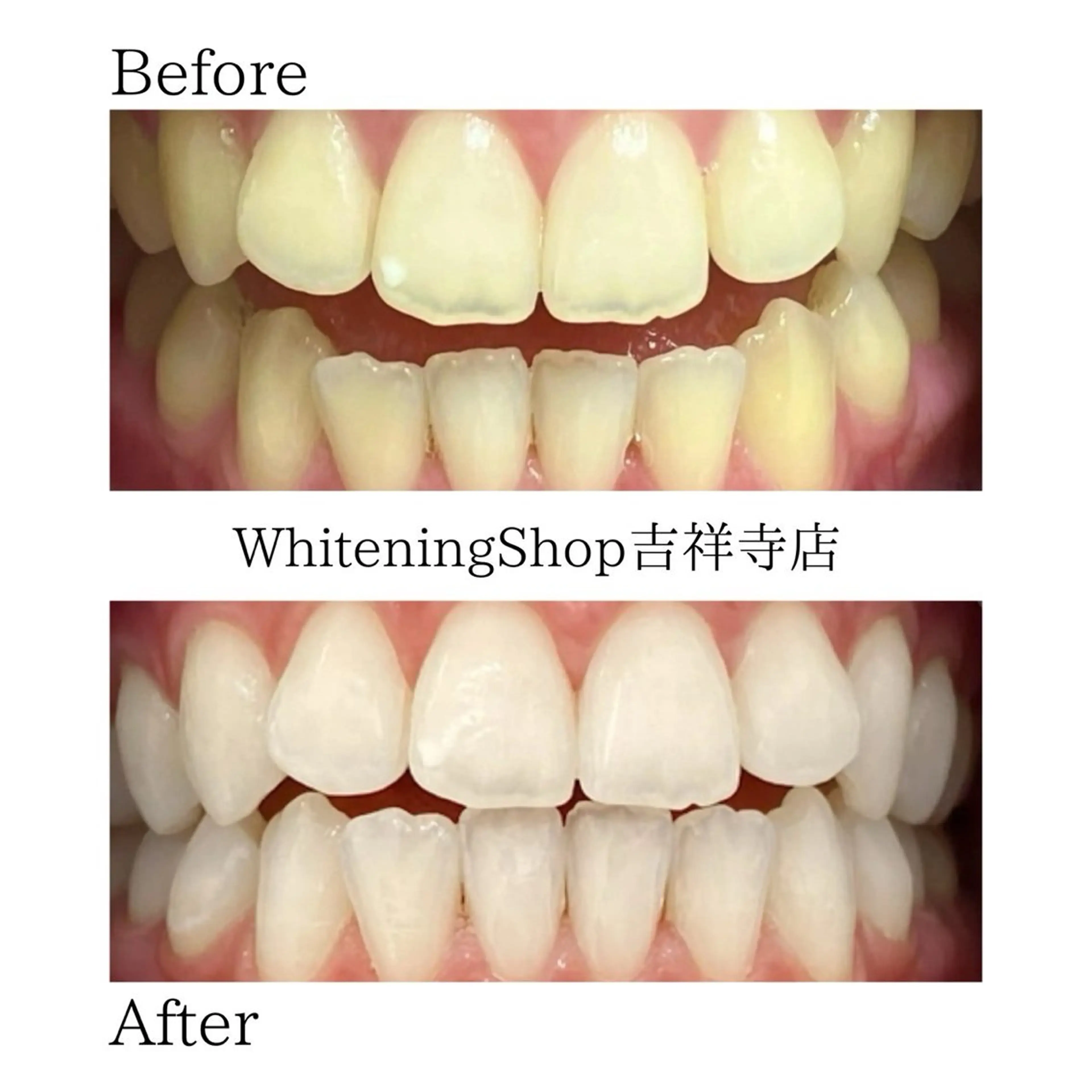 エステ リラク ホワイトニング ショップ吉祥寺店のエステ・リラクイメージ