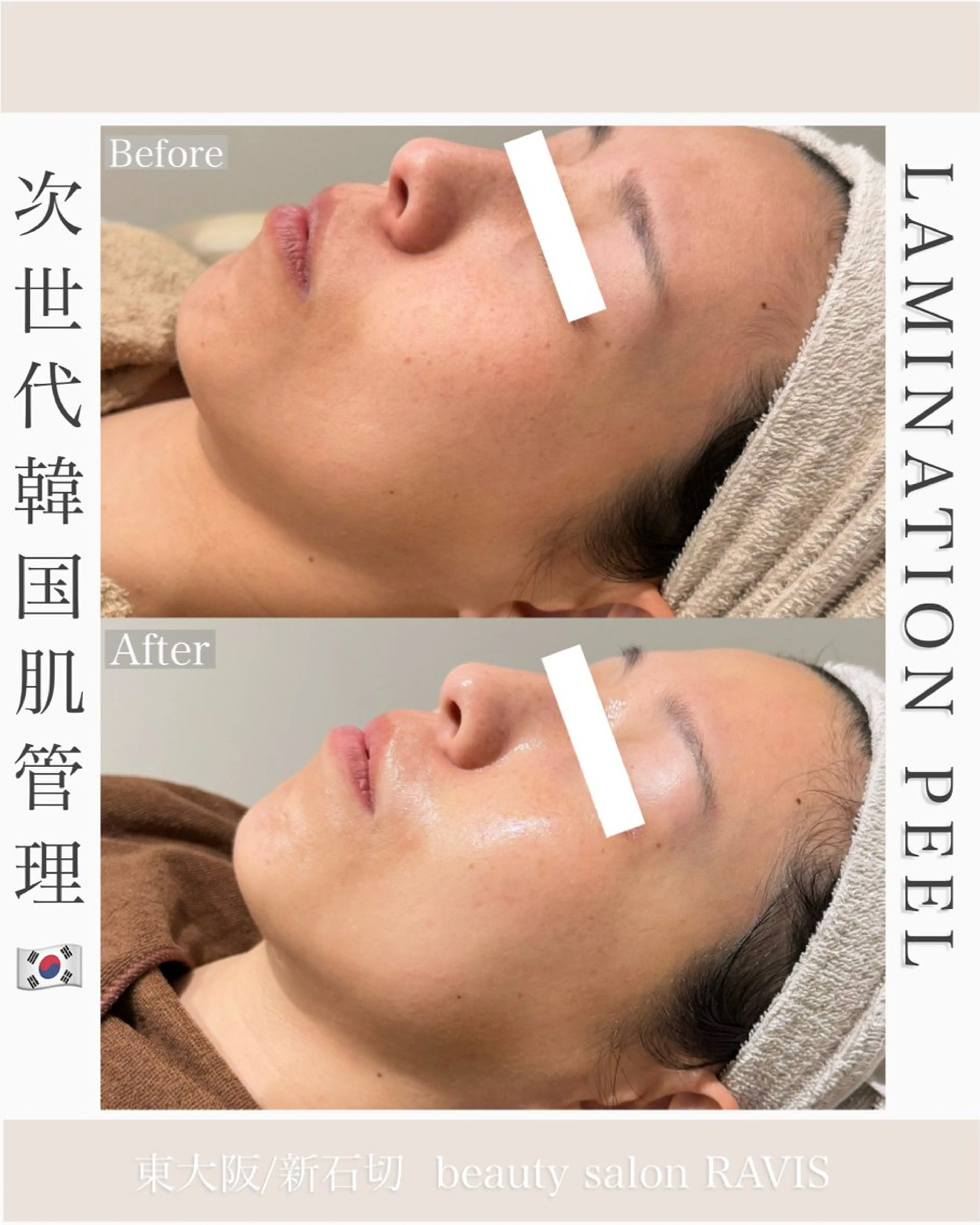 エステ beautysalon RAVIS所属・東大阪/韓国肌管理/ 痩身バスト専門店のエステ・リラクイメージ