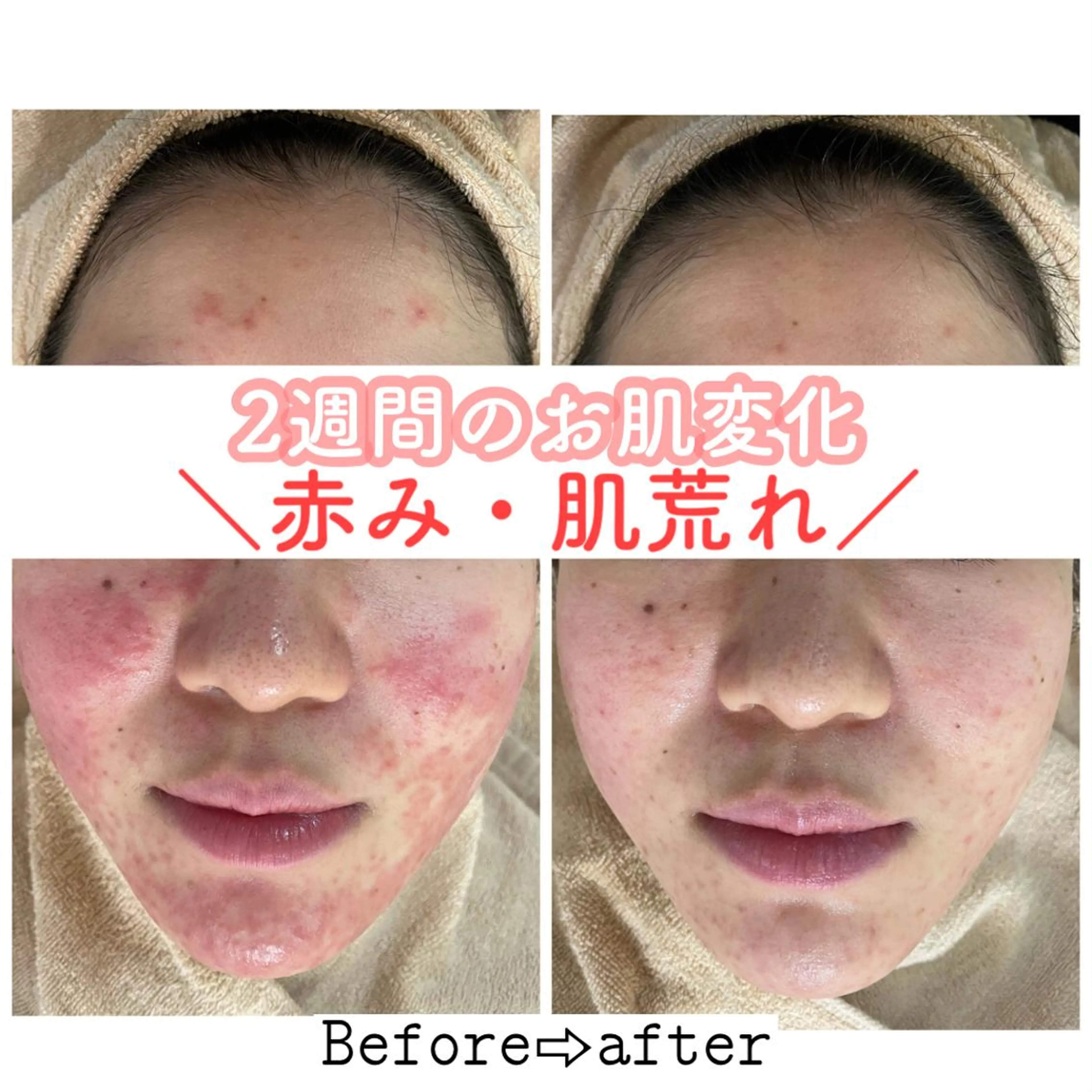 ロング カラー パーマ ヘアアレンジ メンズ キッズ ネイル マツエク・マツパ エステ ニキビ&跡改善サロン オーナー光木のエステ・リラクイメージ