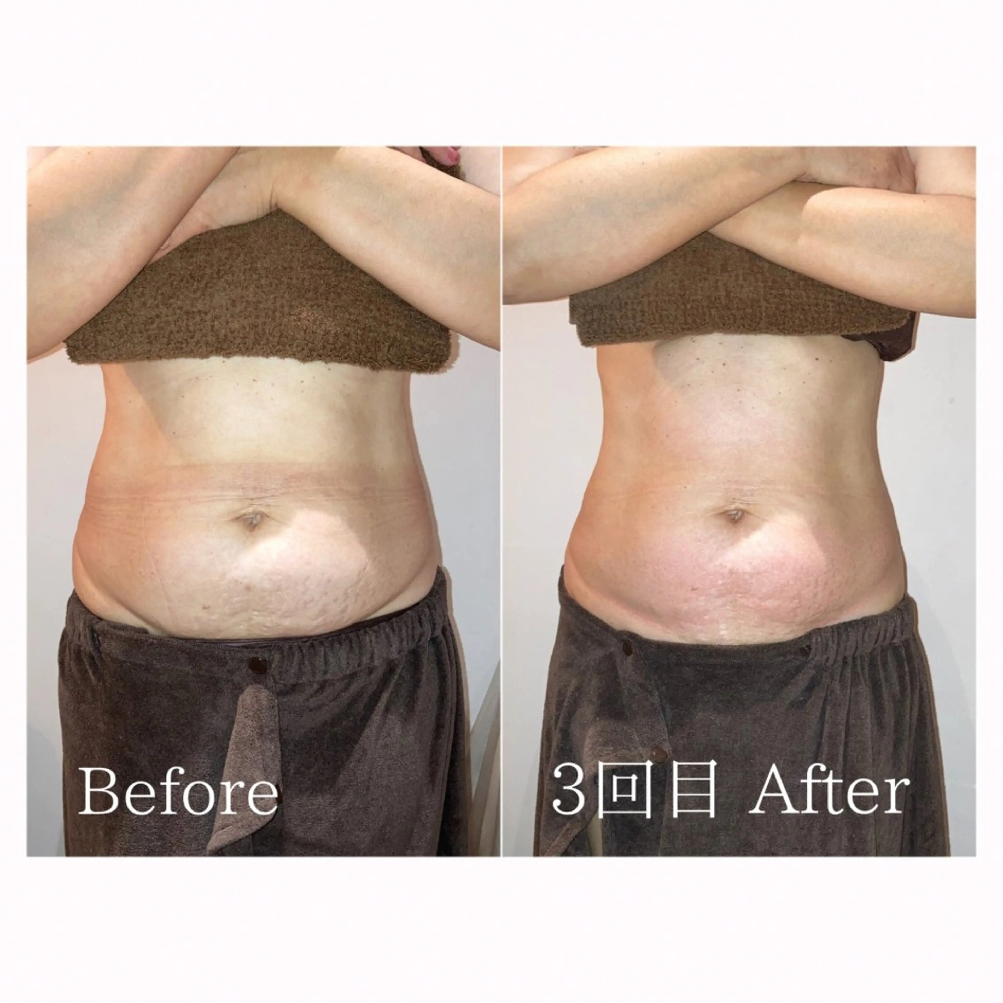 エステ 津村 夏実のエステ・リラクイメージ