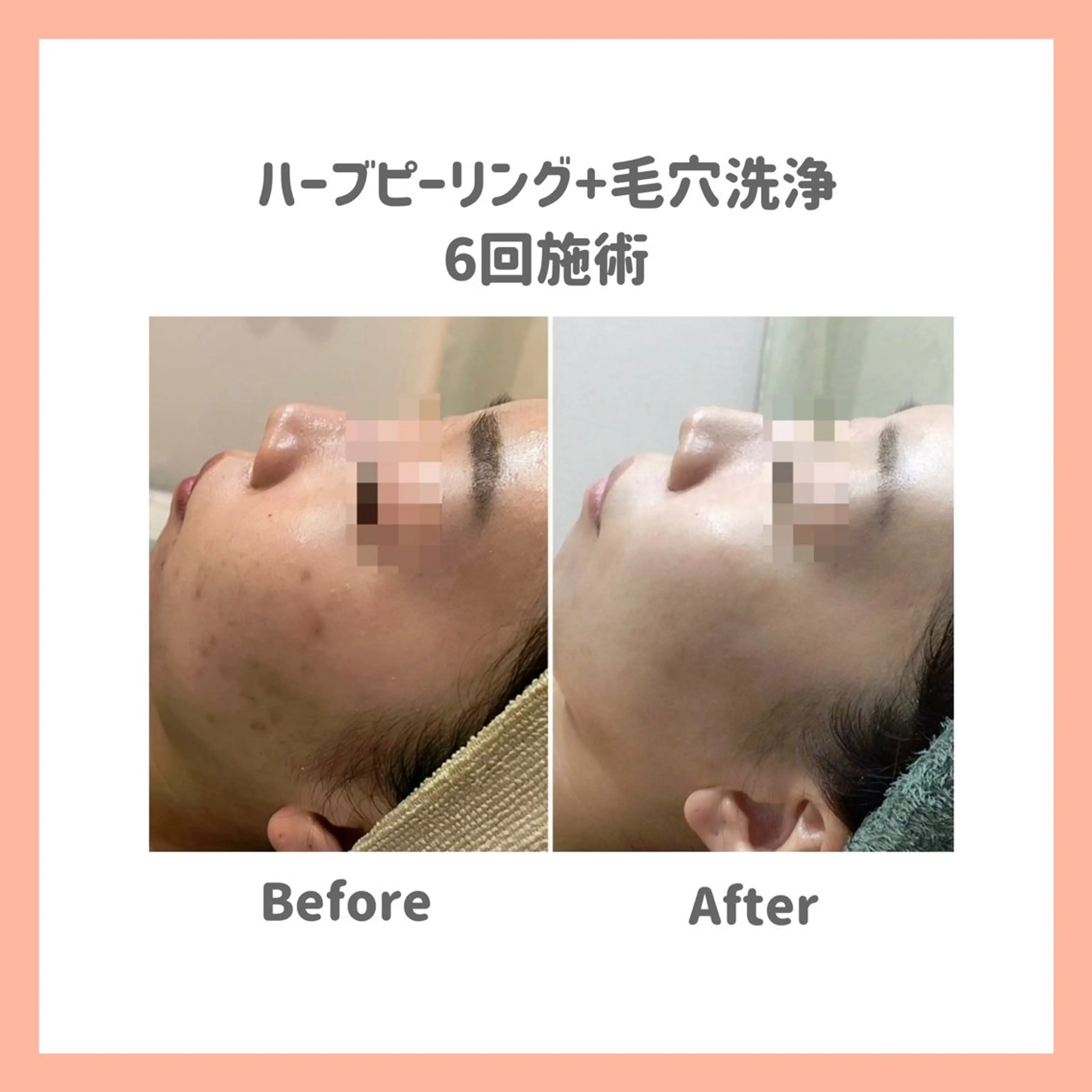 ハーブピーリング専門 muro.のエステ・リラクイメージ