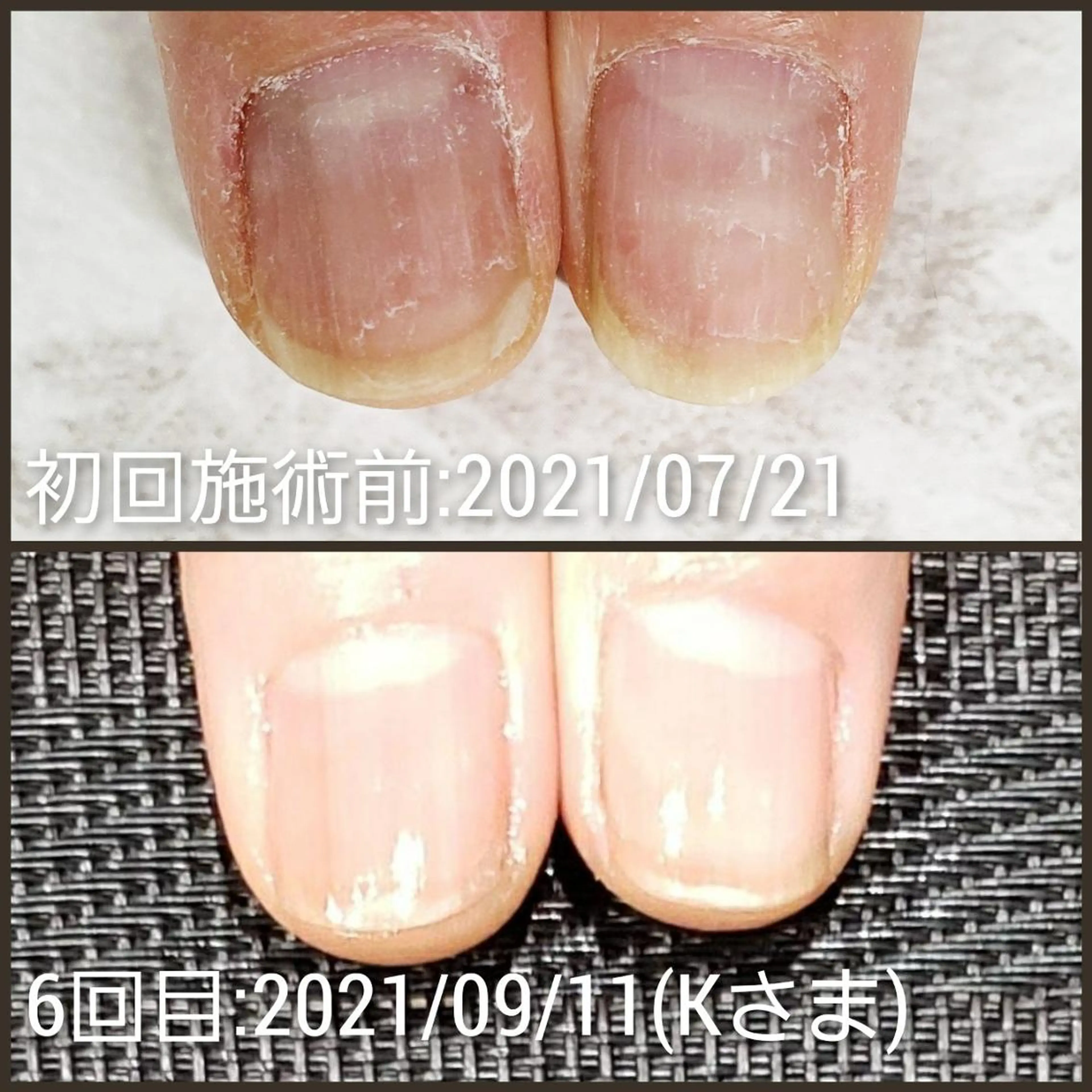 ネイル Fine Valentのマツエク・マツパデザイン