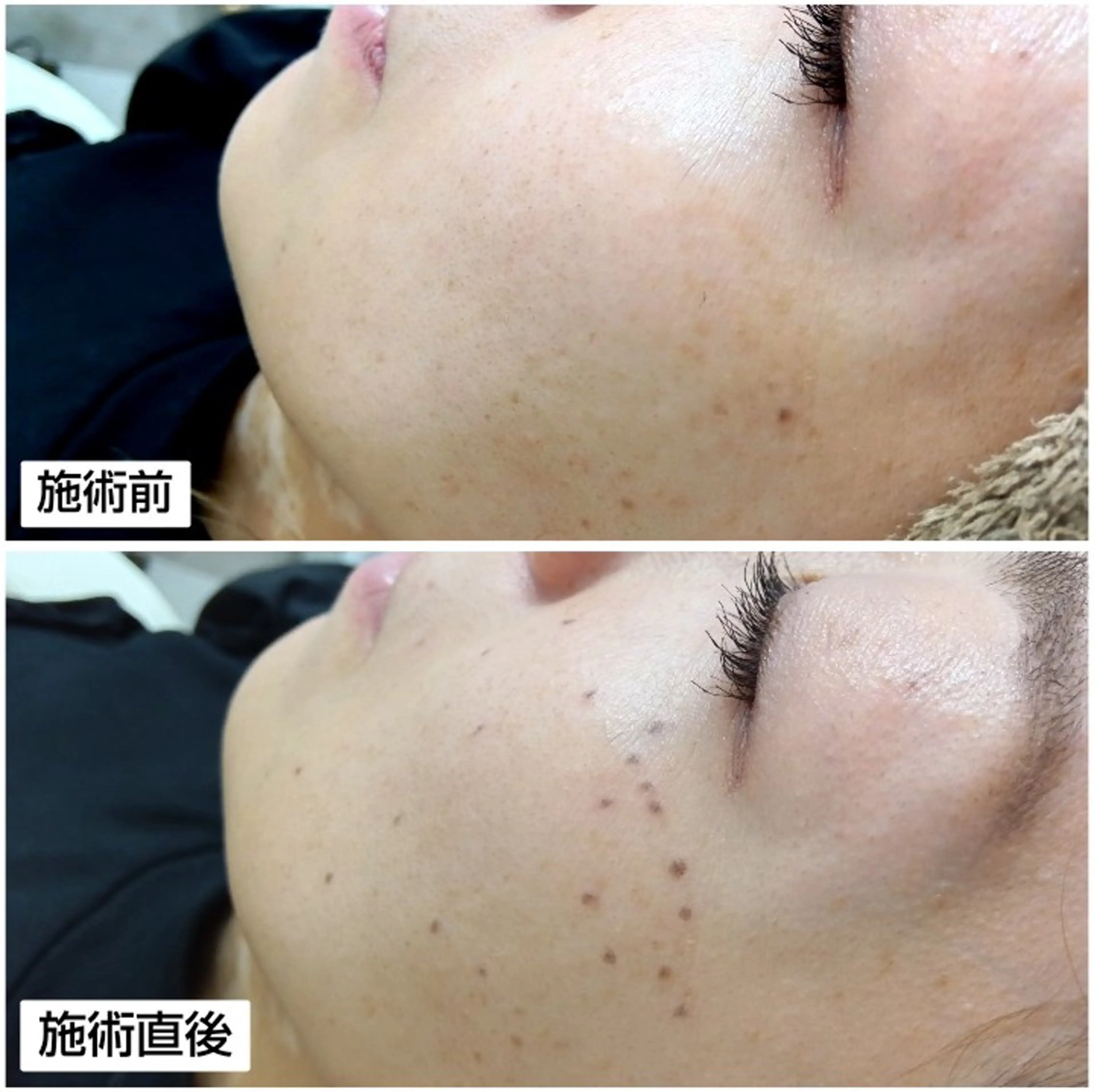 その他 シミケア専門店 HAQUAのその他イメージ