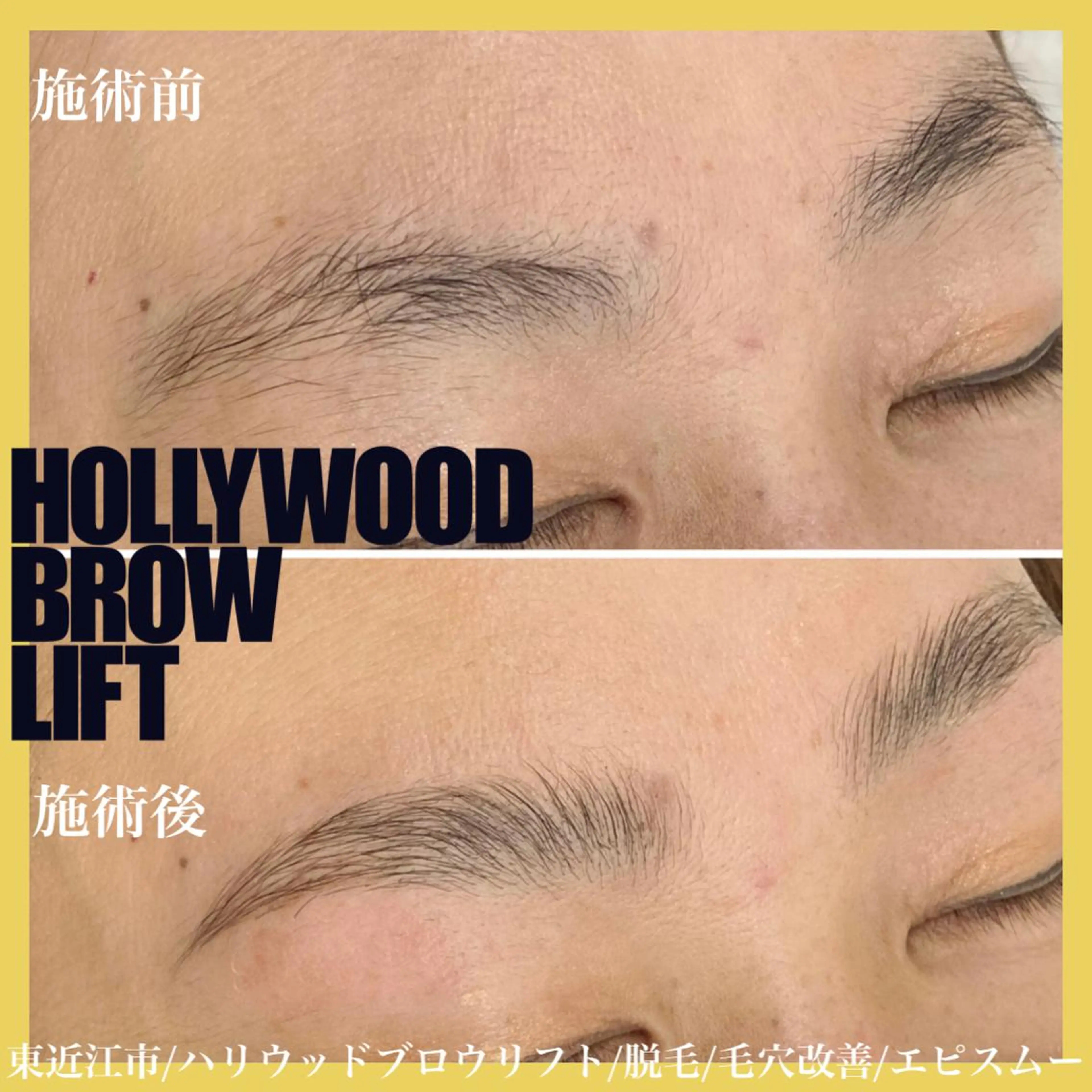 アイブロウ その他(アイブロウ) epismoo 脱毛/HBL/毛穴の眉毛・アイブロウイメージ