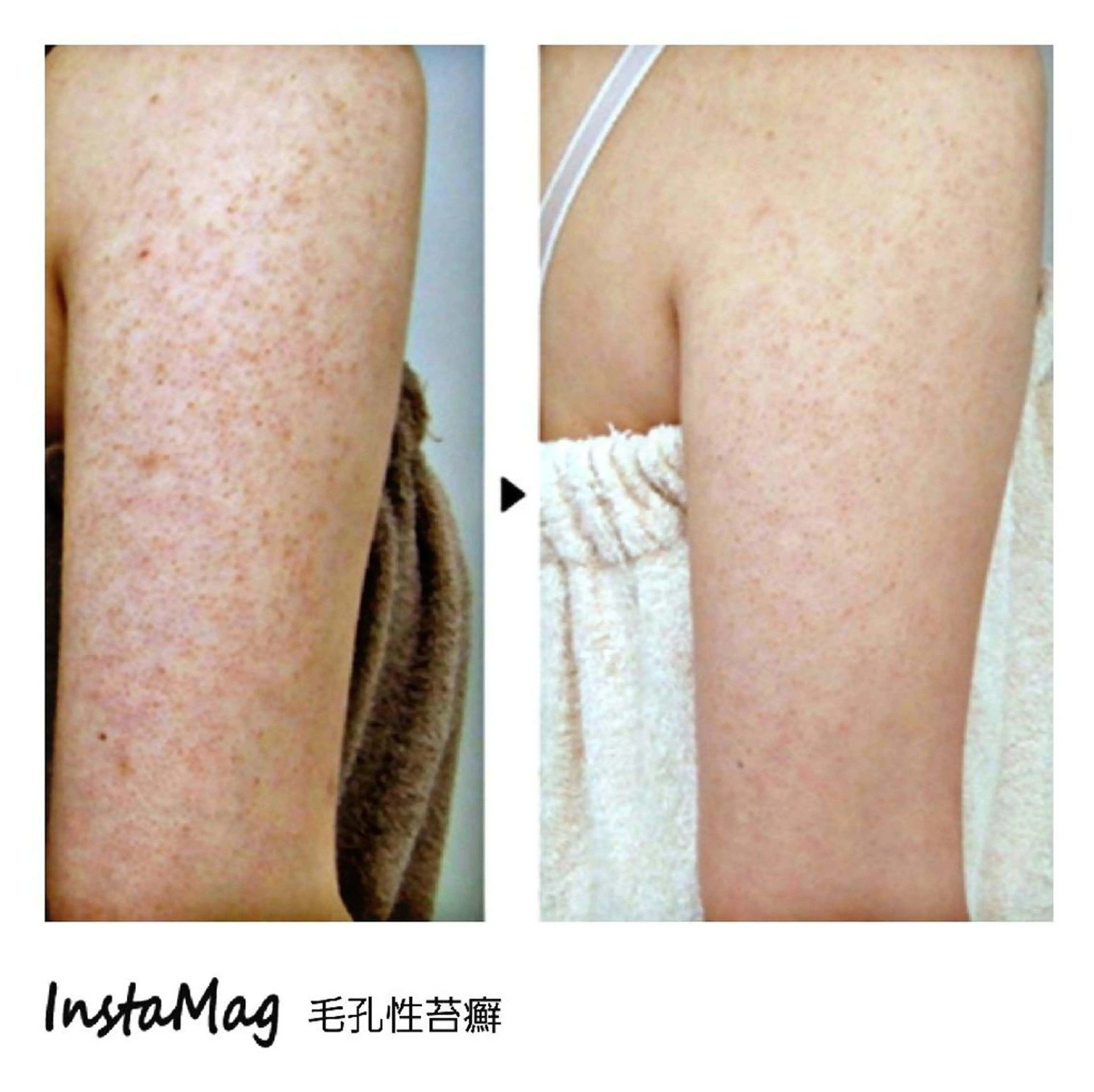 ミディアム カラー メンズ マツエク・マツパ 次世代まつげパーマは 『リベル名古屋』のマツエク・マツパデザイン