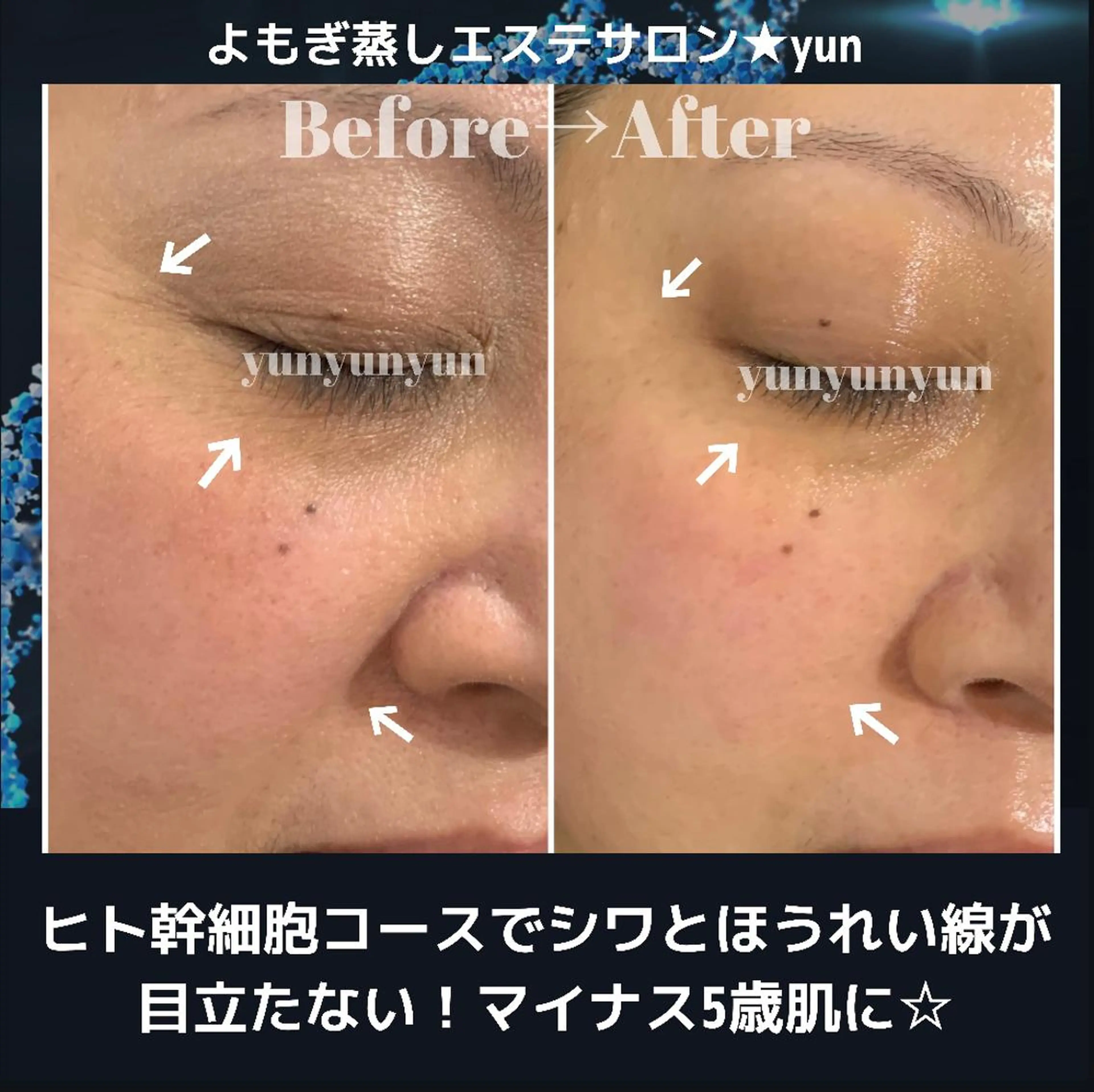 エステ よもぎ蒸しエステサロン★yun所属・よもぎ蒸しサロン ゆんのエステ・リラクイメージ