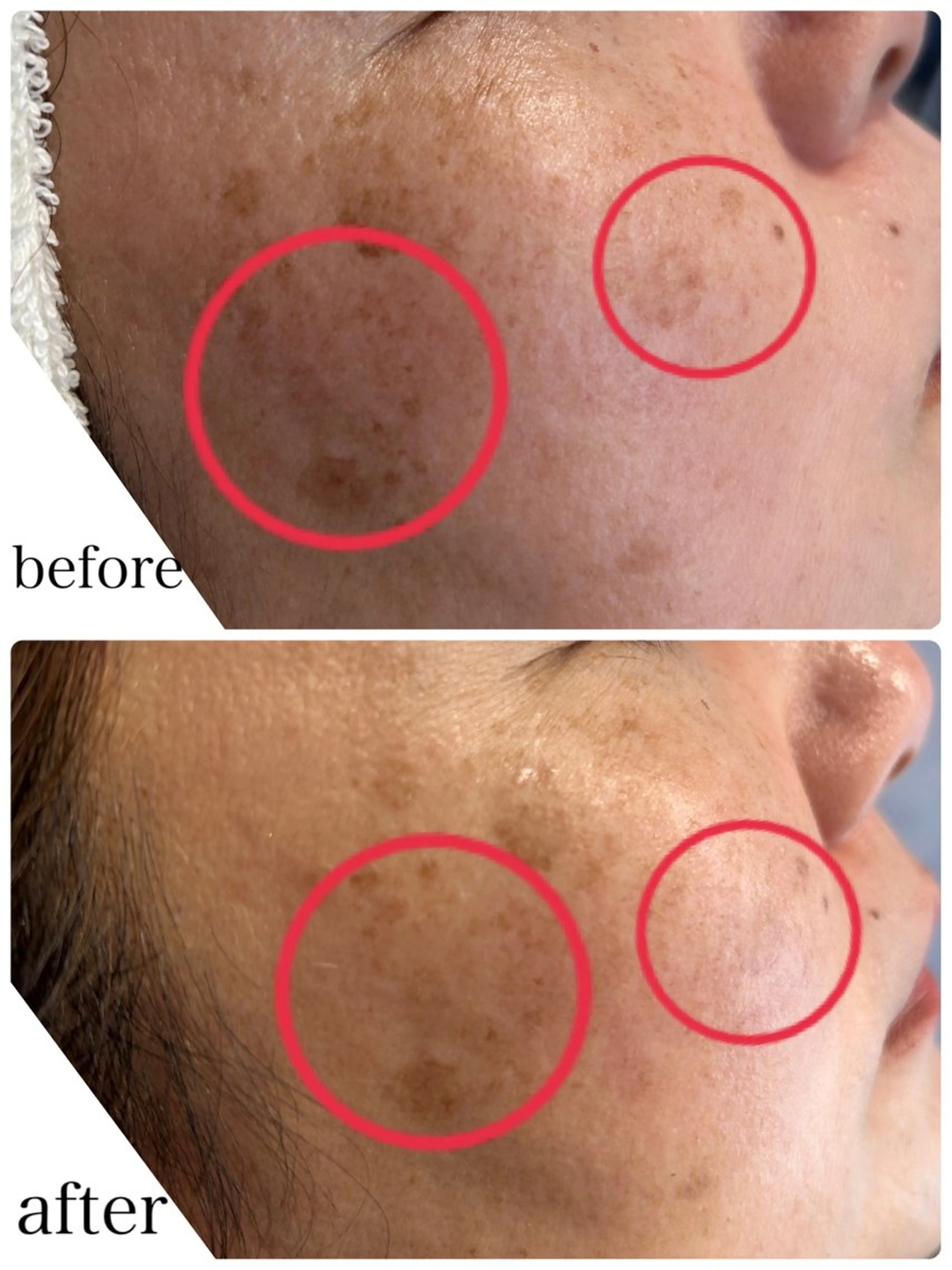 エステ N.style所属・Ｎ. styleのネイルデザイン