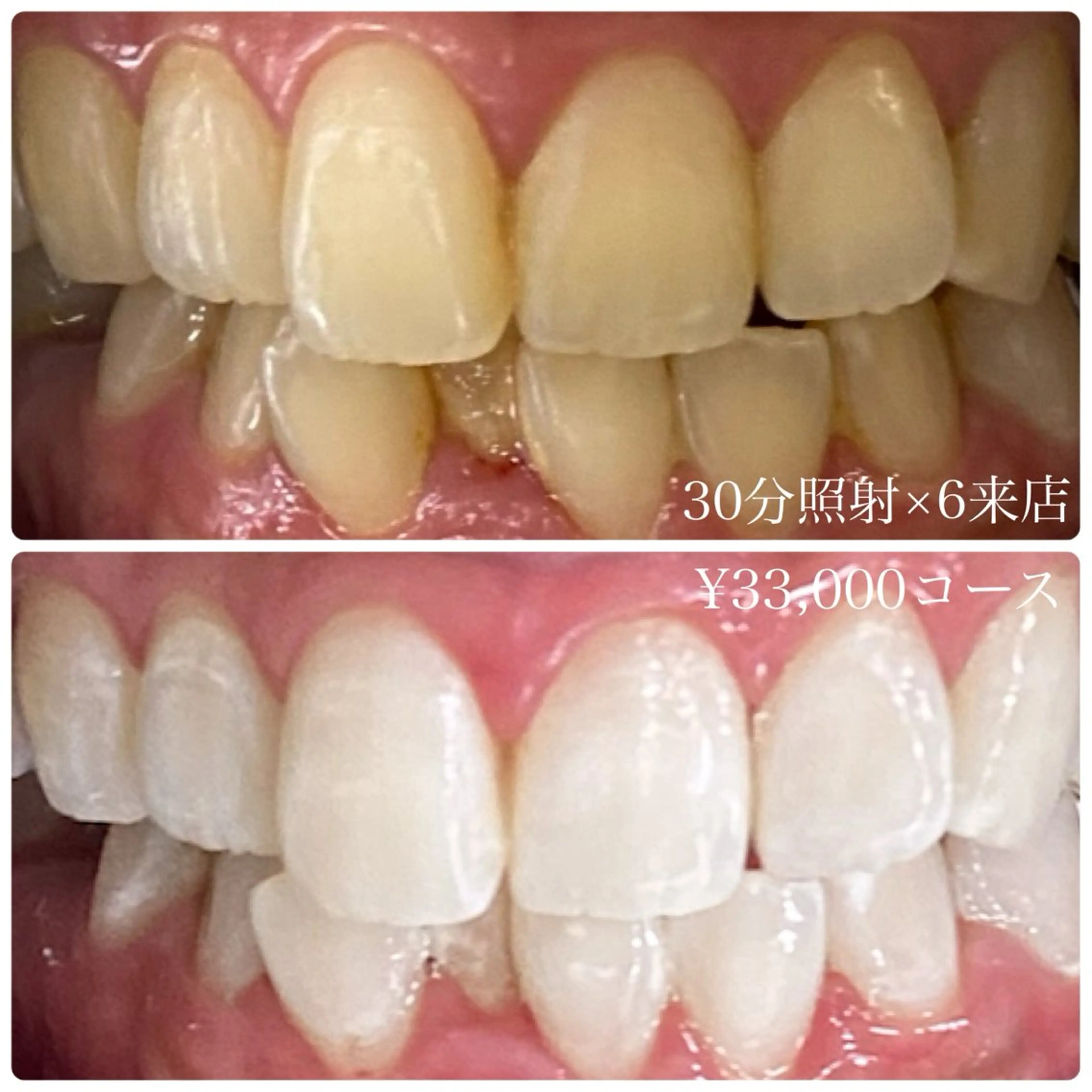 メンズ その他 ホワイトニングルーム　川崎店所属・ホワイトニング ルーム　川崎店のその他イメージ