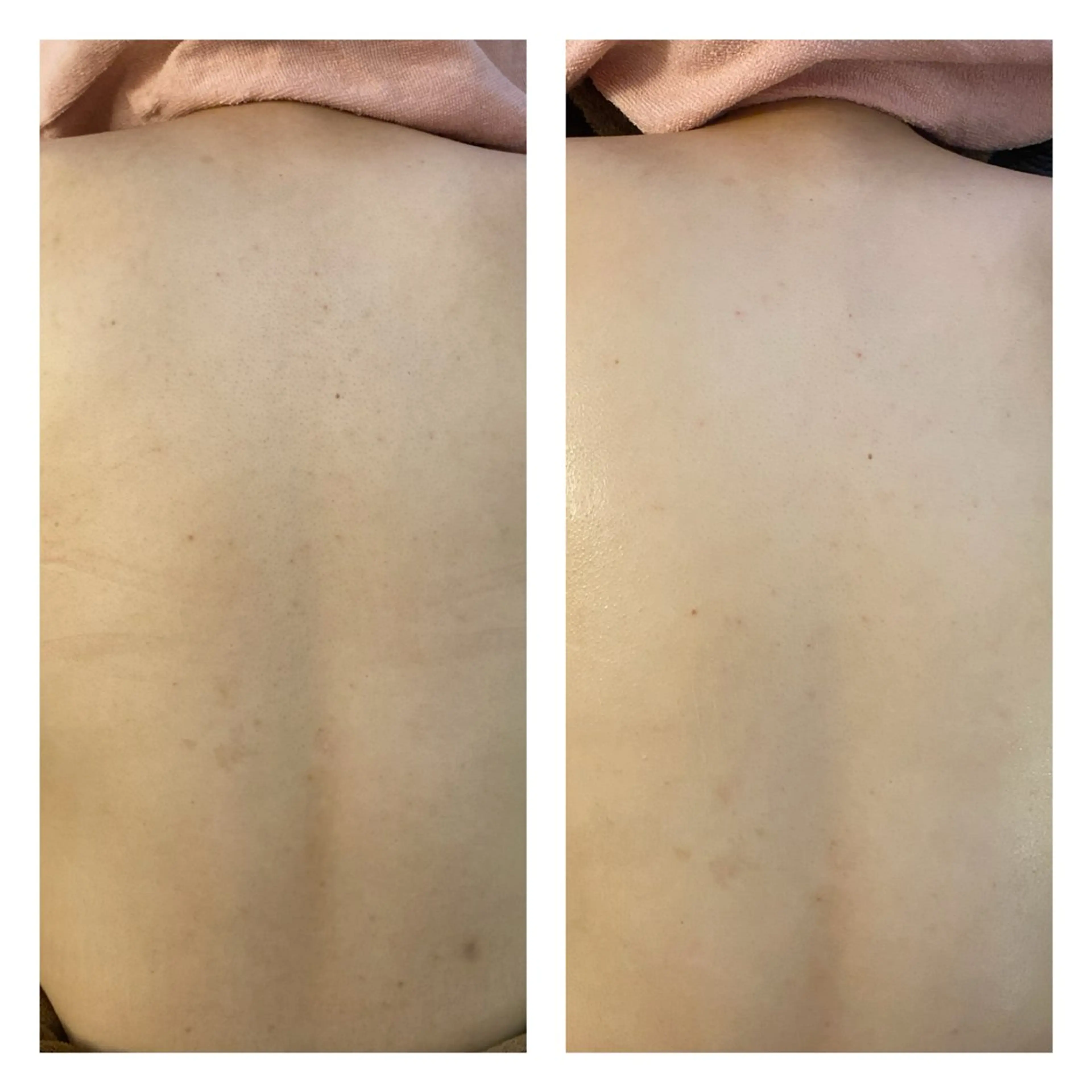 エステ Starry☆Sky 【YUMI】のエステ・リラクイメージ