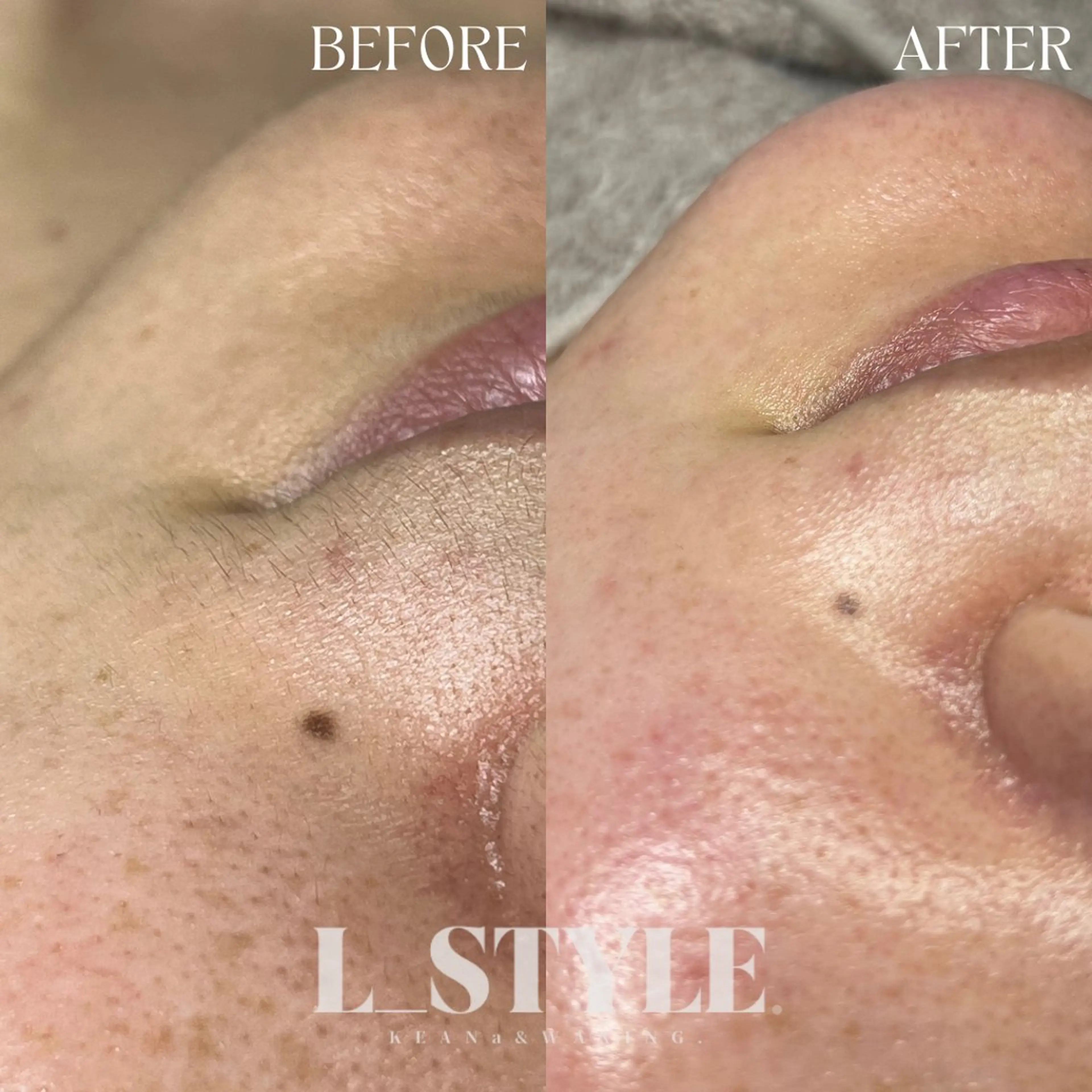 韓国式美人肌育成/美肌WAXサロン【L_style.】所属・【L_style.】 エルスタイルのエステ・リラクイメージ