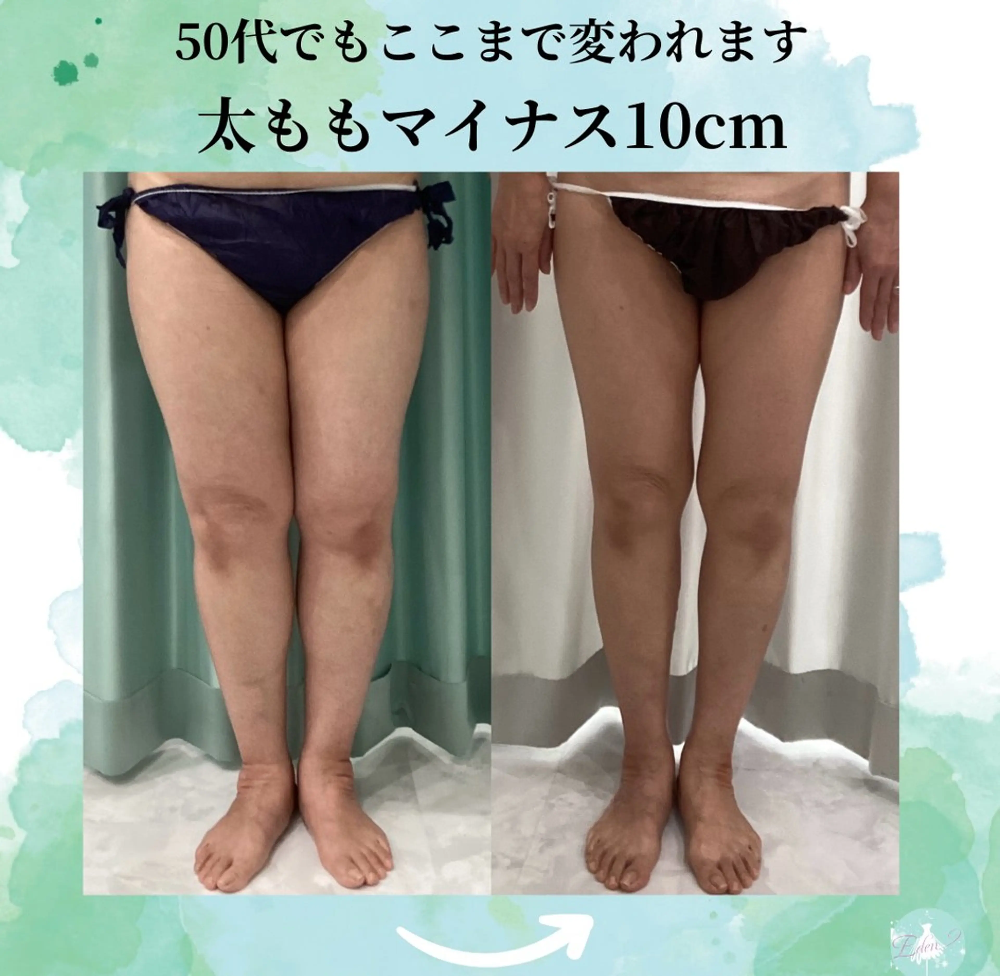 エステ♡Eden Asamiのエステ・リラクイメージ