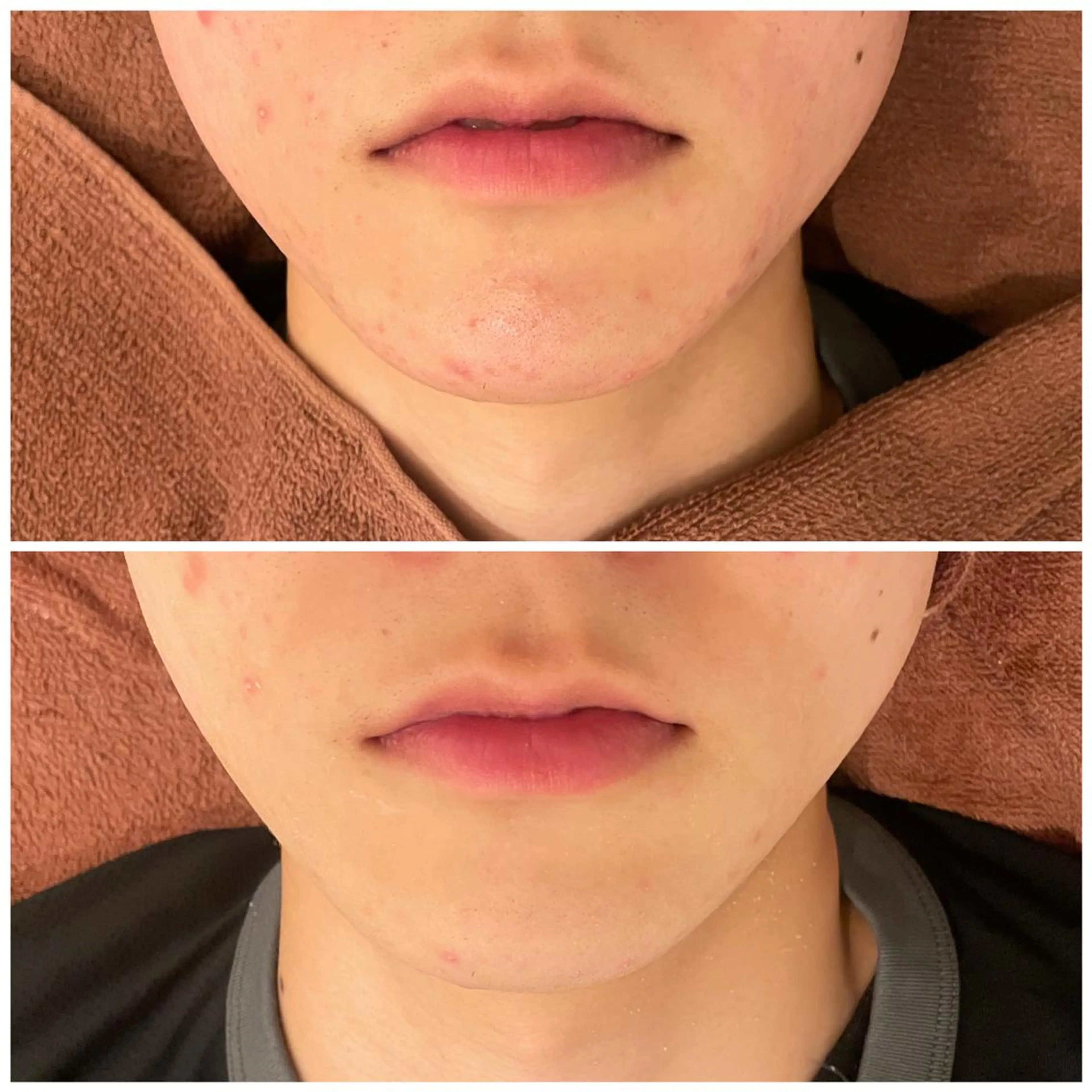 セミロング カラー パーマ ヘアアレンジ メンズ ネイル マツエク・マツパ アイブロウ エステ リラク ニキビ特化型エステ 🍓最短で肌質改善のエステ・リラクイメージ