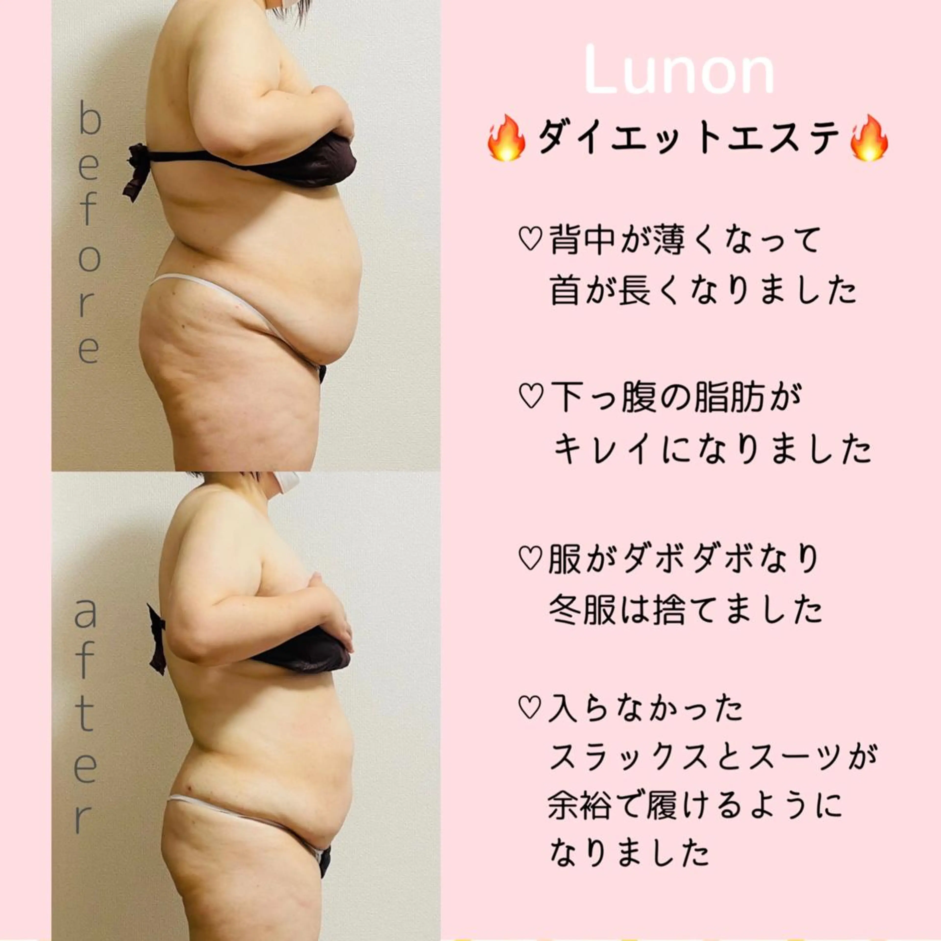 Lunon 【ルノン】のエステ・リラクイメージ