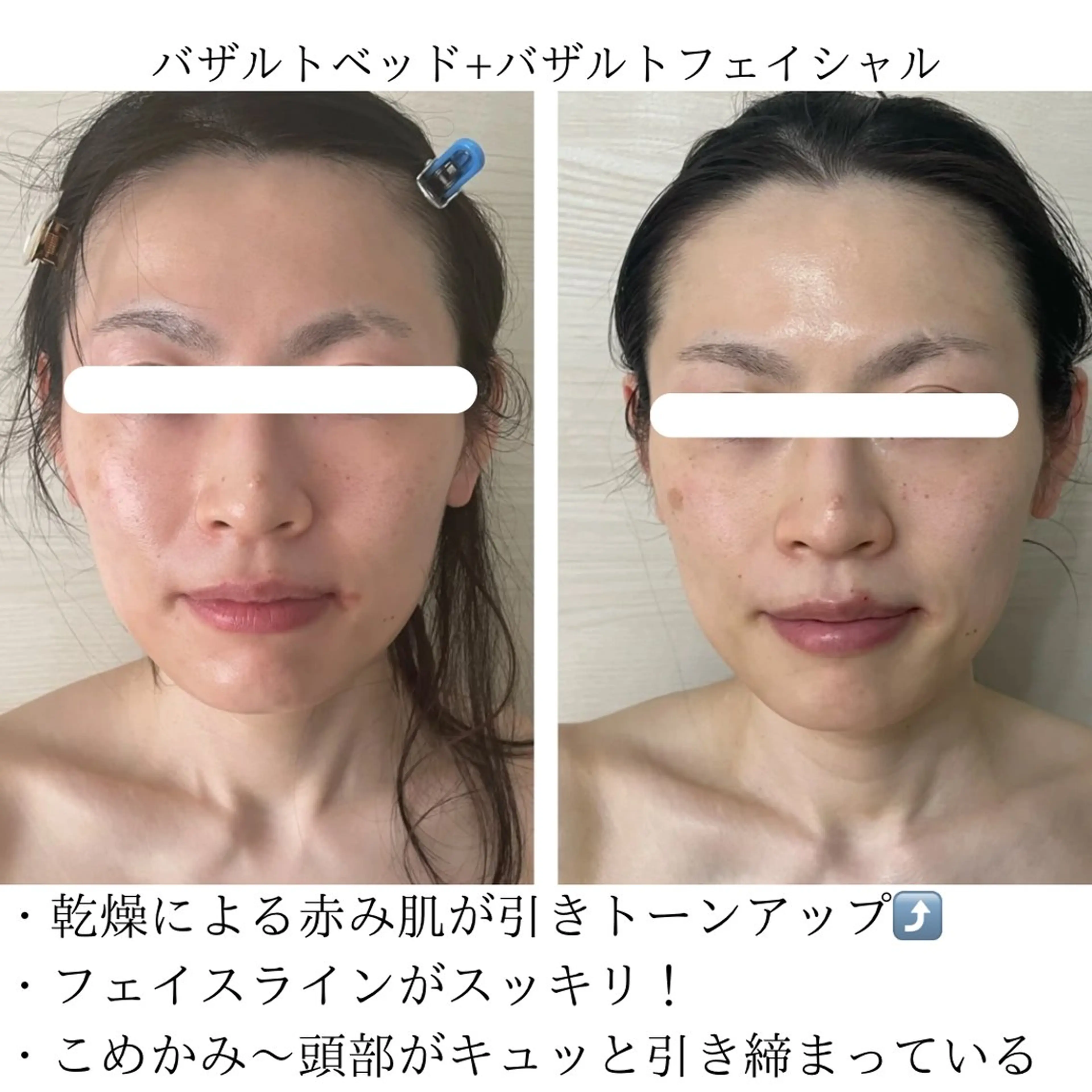 LA・PUR所属・LA・ PURのエステ・リラクイメージ