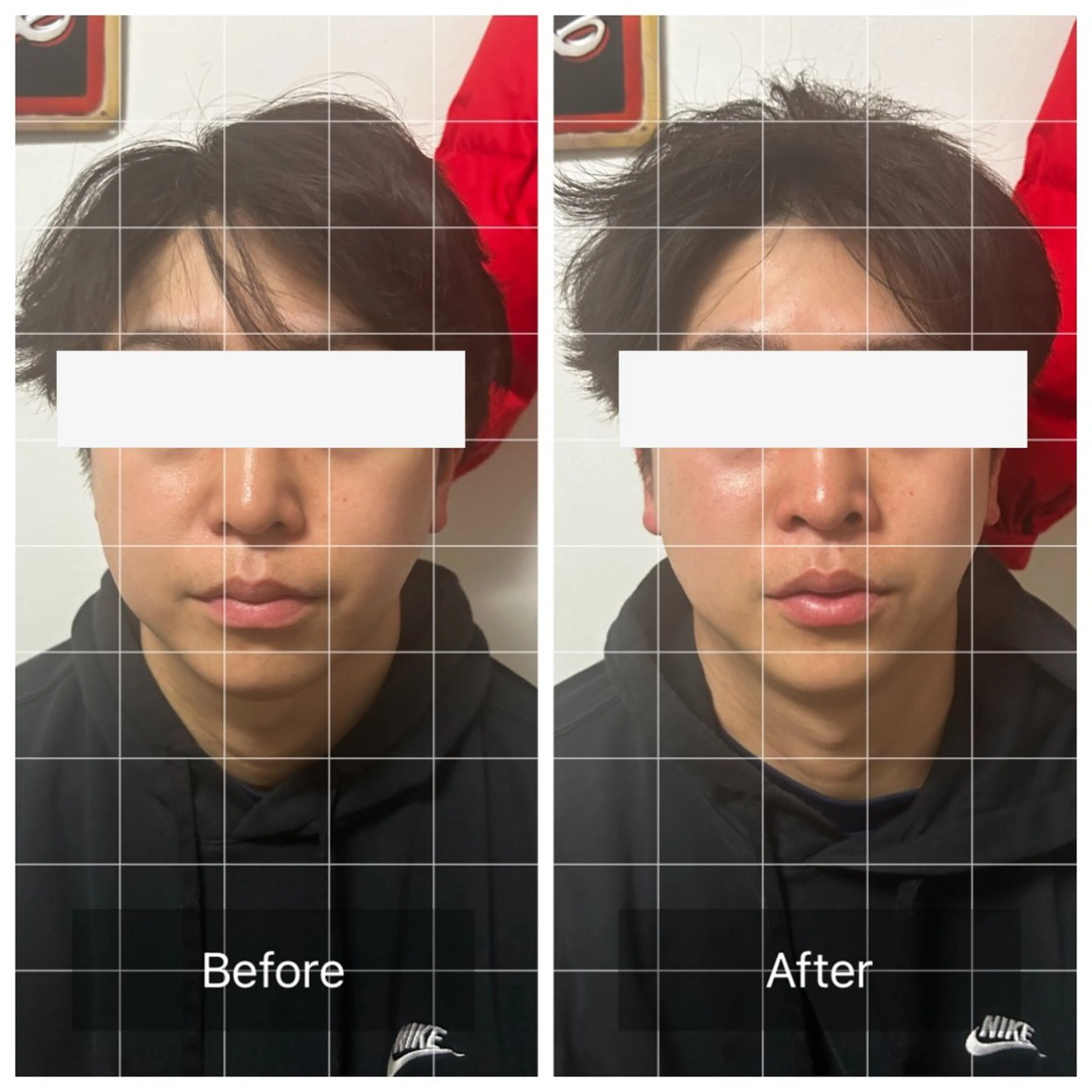 【スッキリ小顔！】メンズ小顔矯正＋ドライヘッドスパの写真