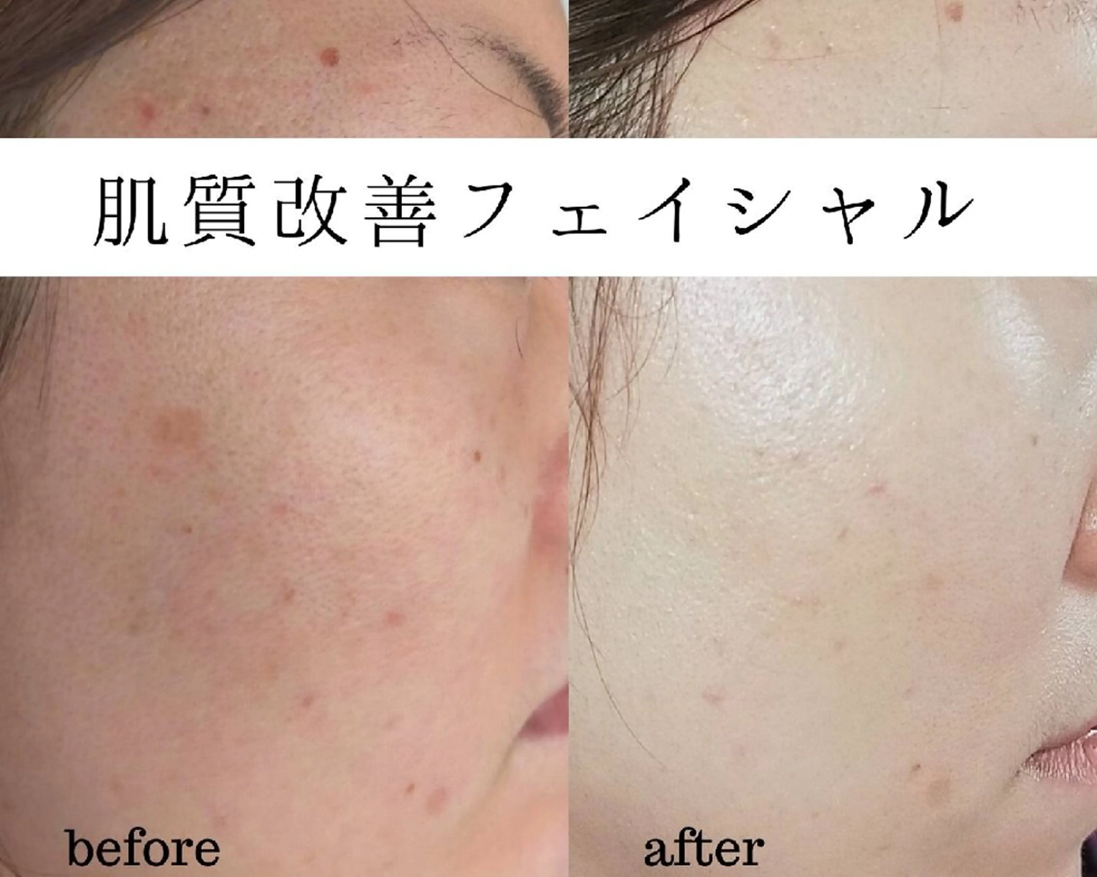 ユニセックスエステサロンUniclear所属・痩身&フェイシャル Uniclearのエステ・リラクイメージ