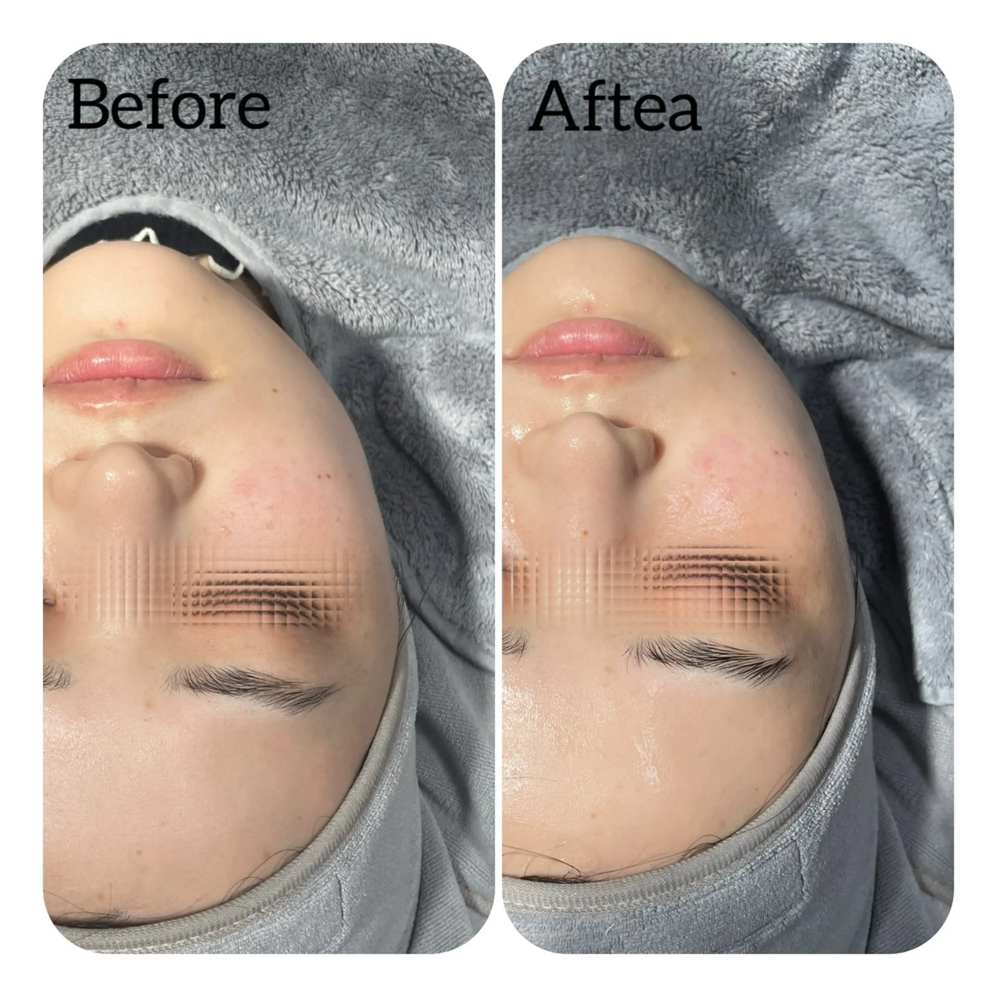 エステ Éclat de Belle🫧白玉肌のエステ・リラクイメージ