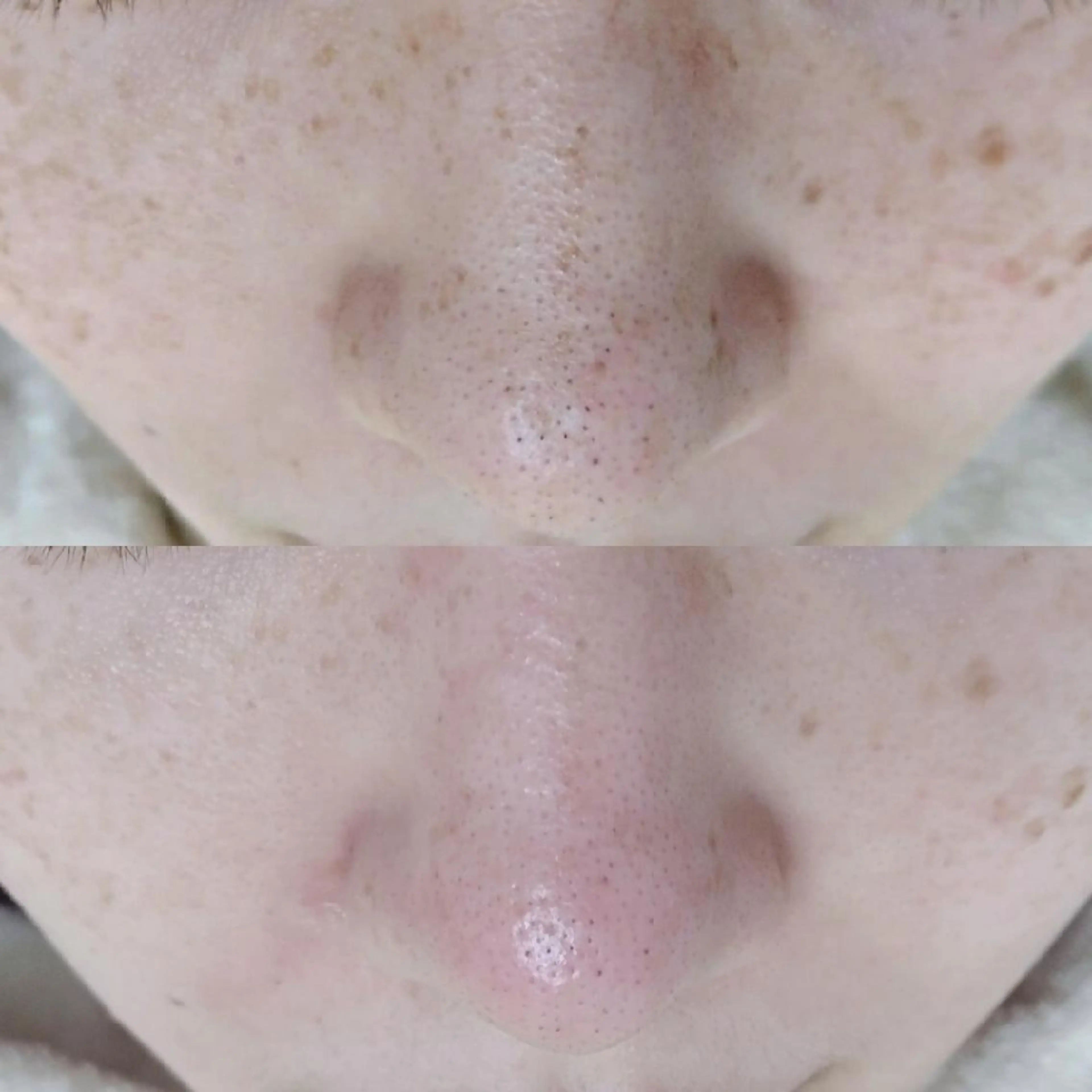 ユニセックスエステサロンUniclear所属・痩身&フェイシャル Uniclearのエステ・リラクイメージ